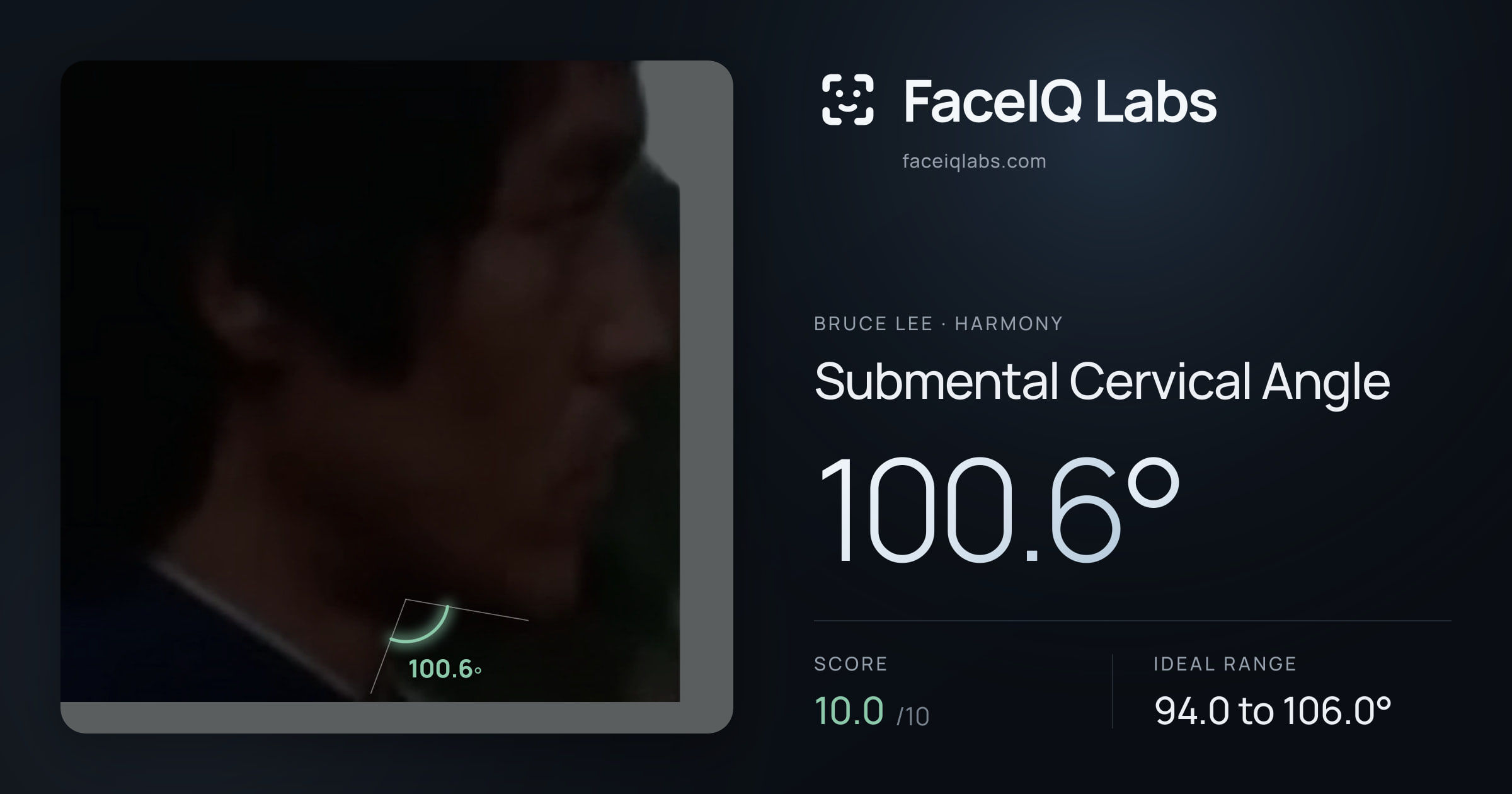 Bruce Lee Submental Cervical Angle: 100.6°, drawn on the photo