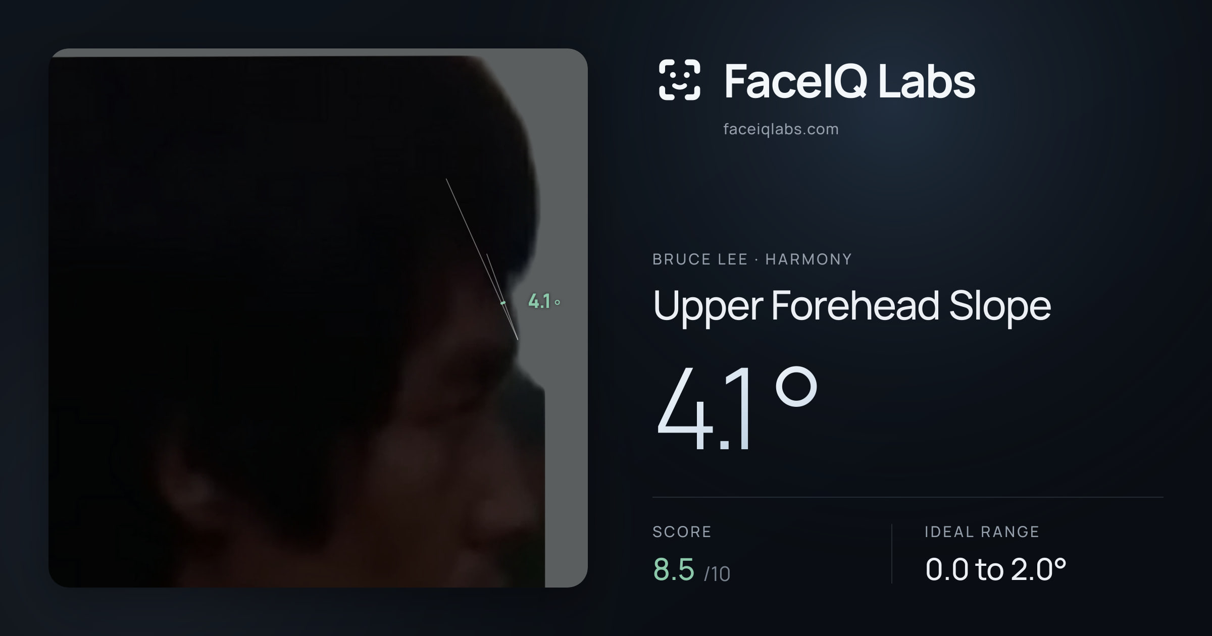 Bruce Lee Upper Forehead Slope: 4.1°, drawn on the photo