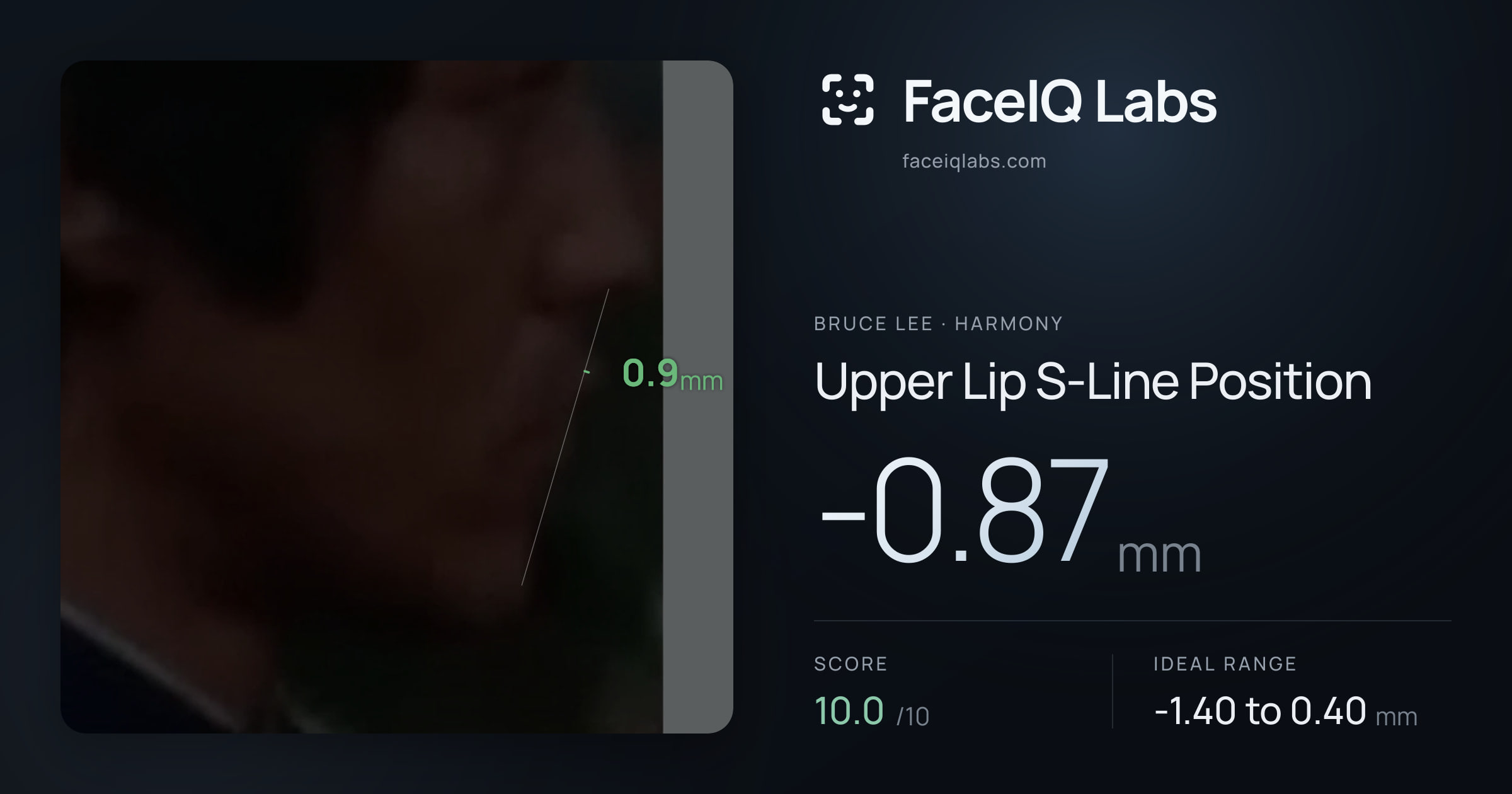 Bruce Lee Upper Lip S-Line Position: -0.87mm, drawn on the photo