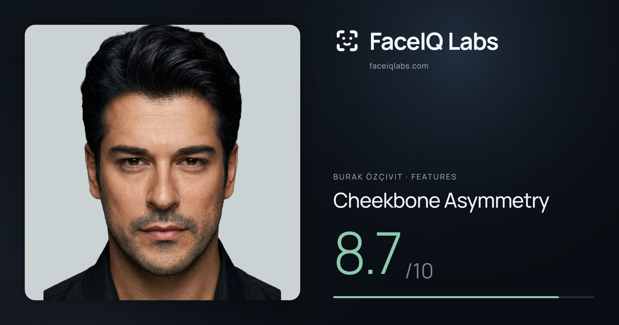 Burak Özçivit Cheekbone Asymmetry: 8.7/10, drawn on the photo