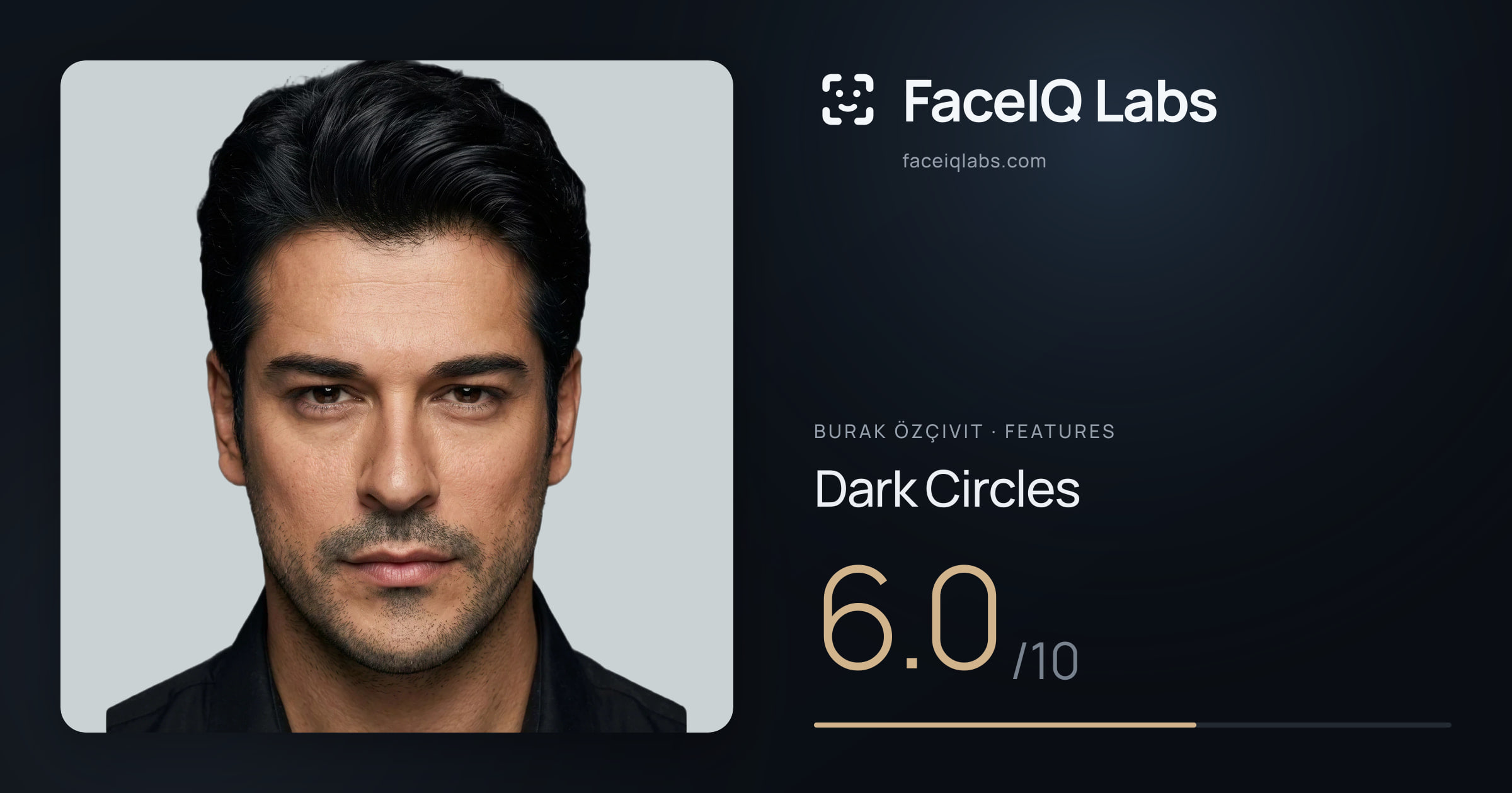 Burak Özçivit Dark Circles: 6.0/10, drawn on the photo