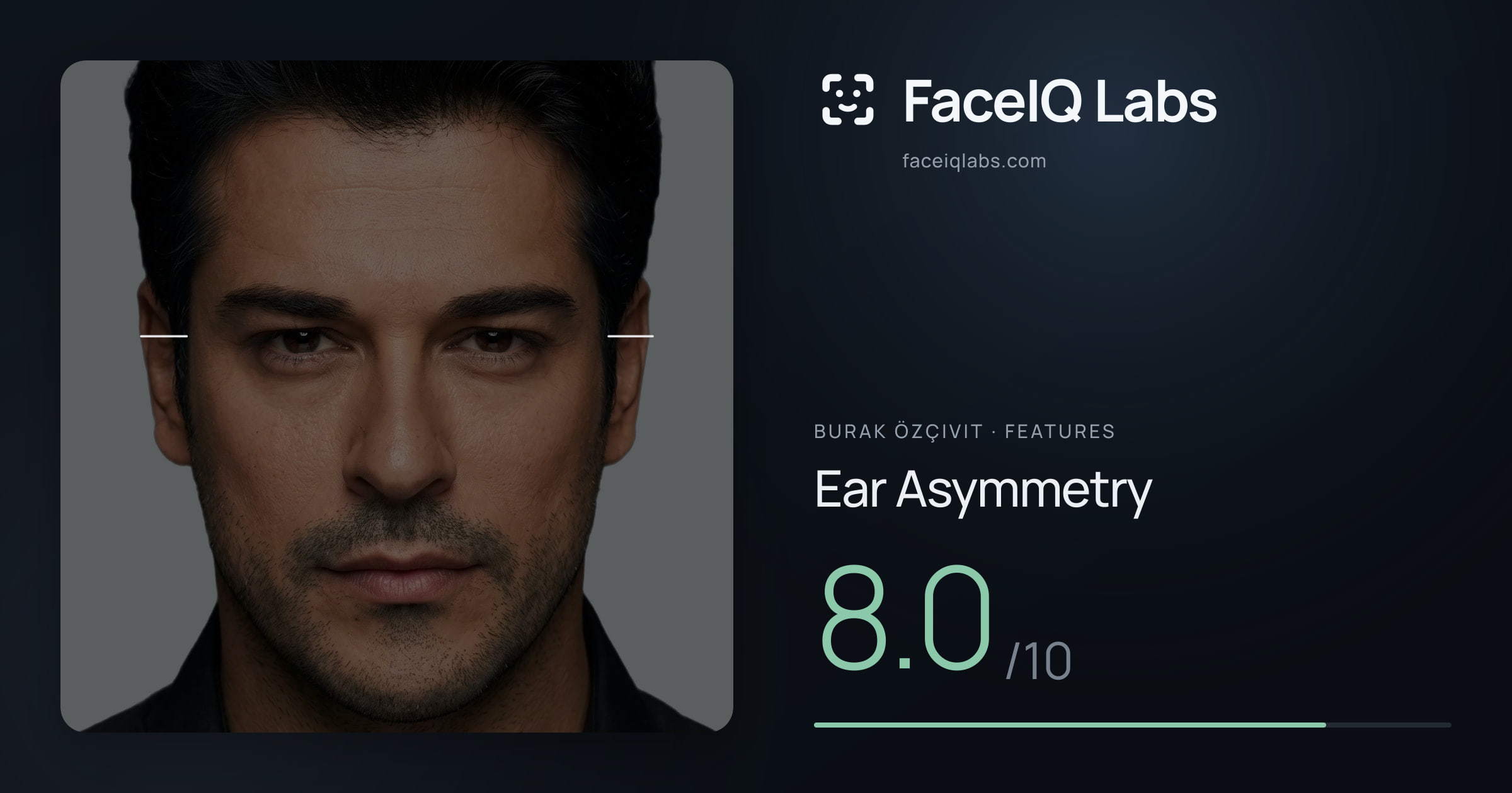 Burak Özçivit Ear Asymmetry: 8.0/10, drawn on the photo
