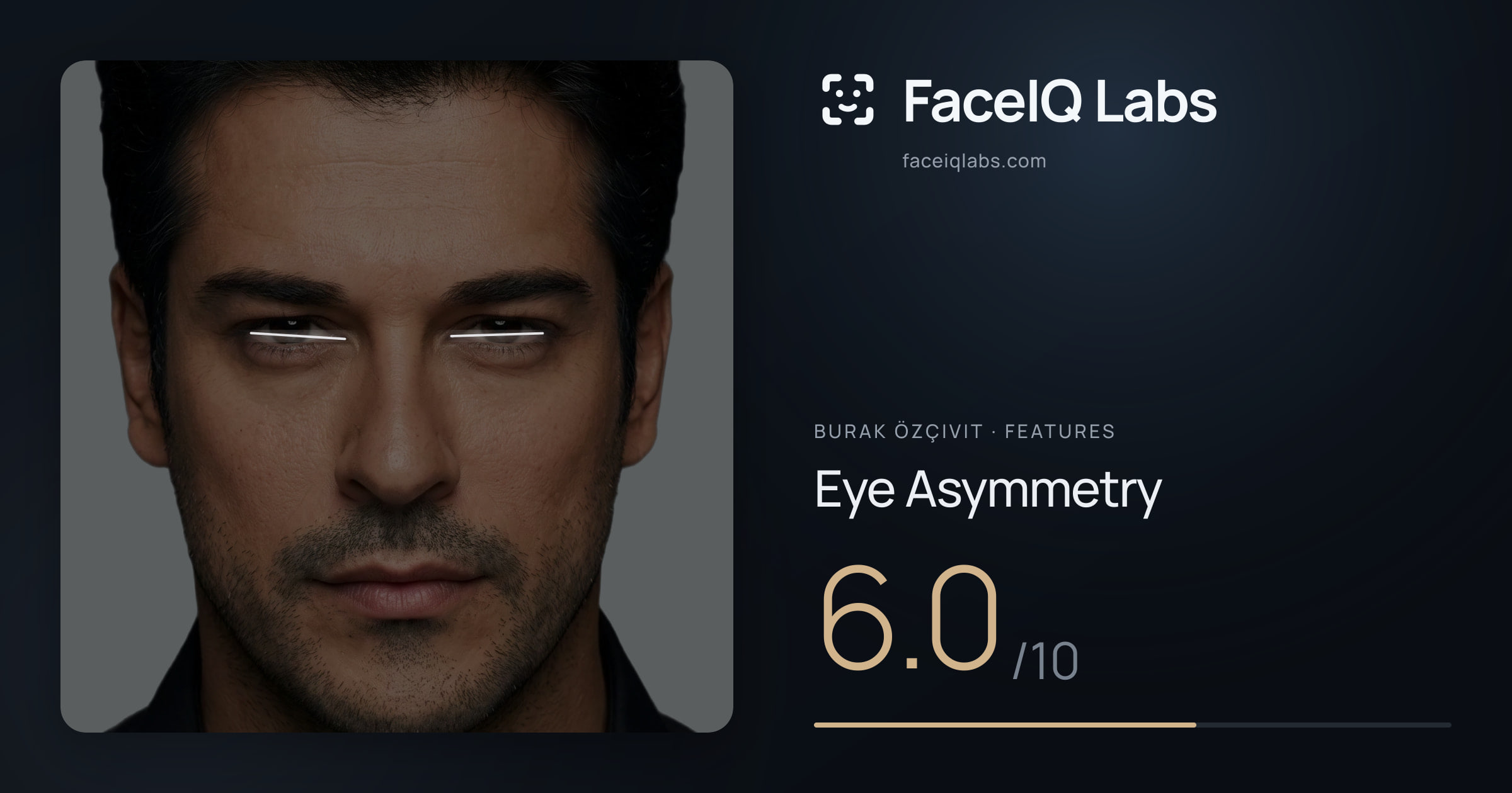 Burak Özçivit Eye Asymmetry: 6.0/10, drawn on the photo