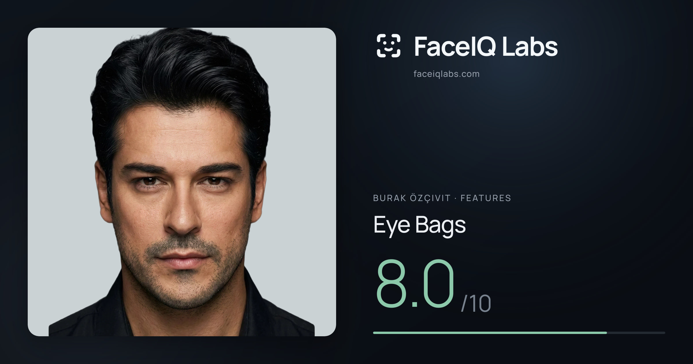 Burak Özçivit Eye Bags: 8.0/10, drawn on the photo