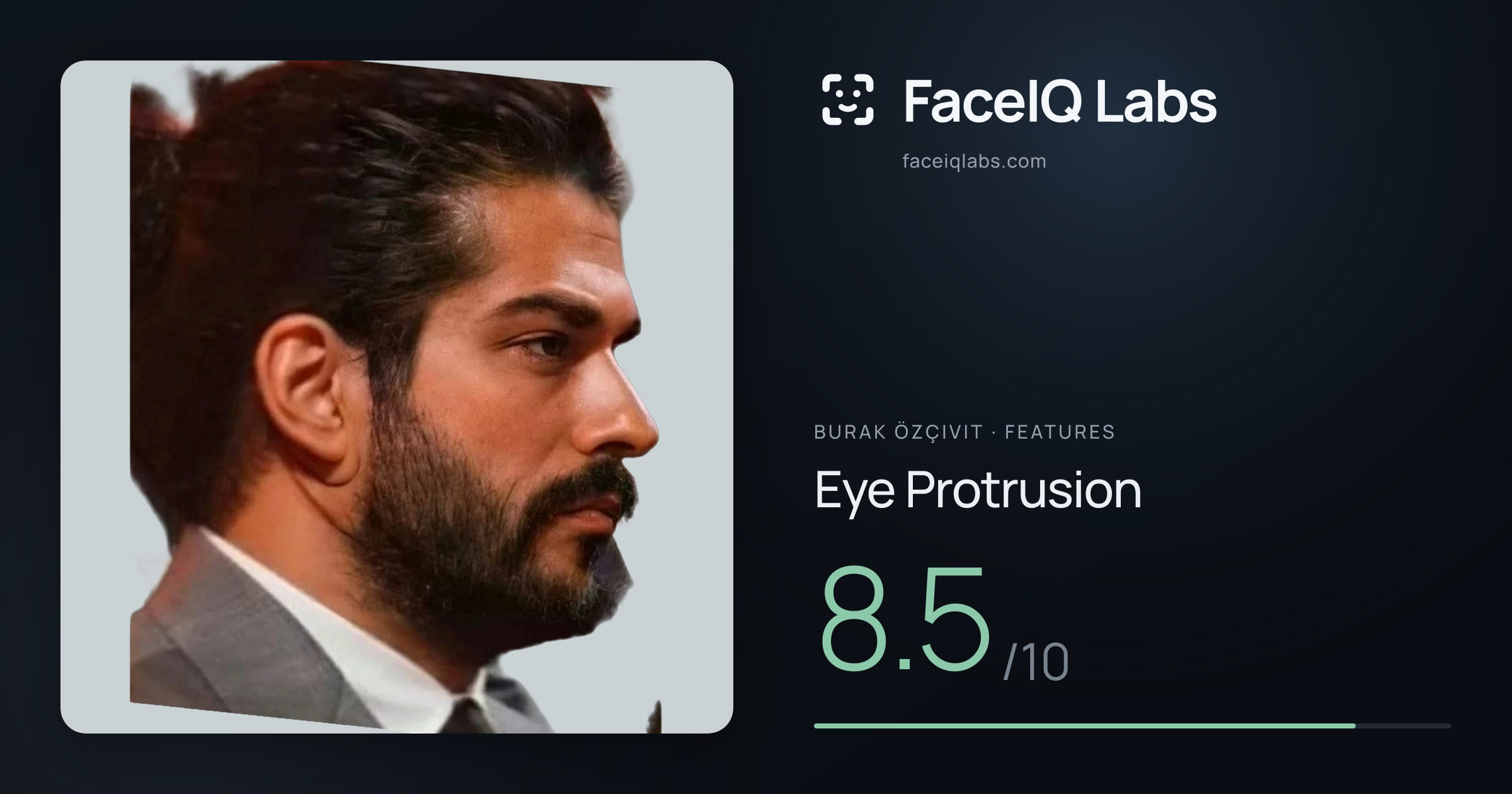 Burak Özçivit Eye Protrusion: 8.5/10, drawn on the photo