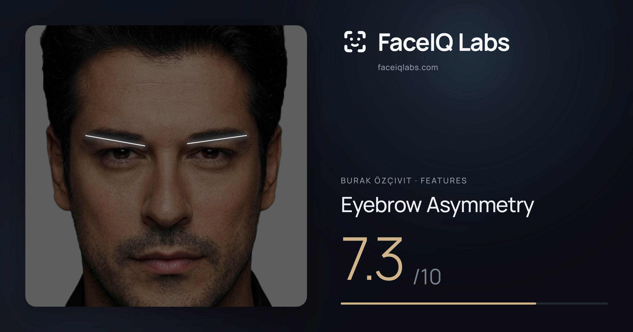 Burak Özçivit Eyebrow Asymmetry: 7.3/10, drawn on the photo