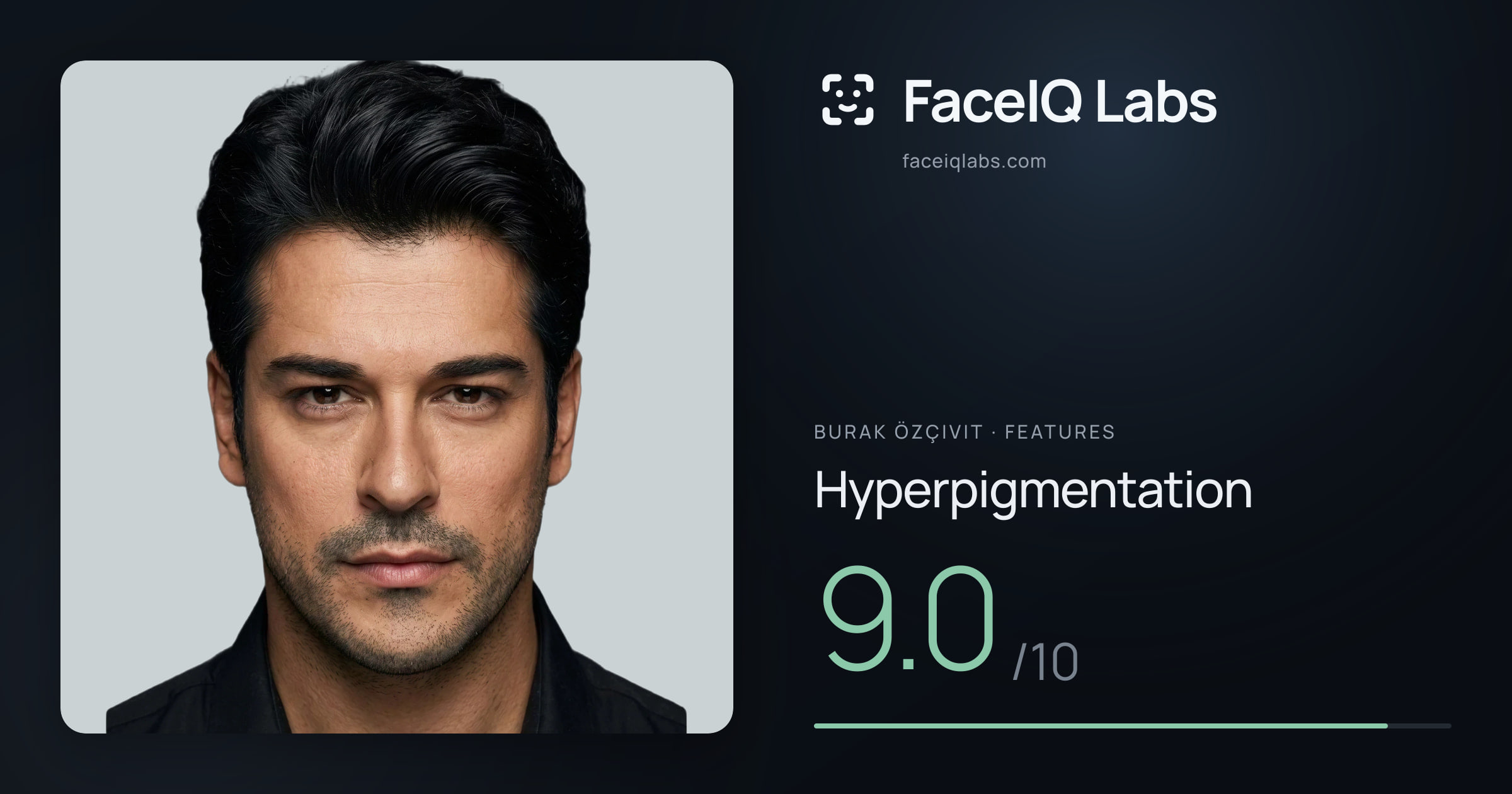 Burak Özçivit Hyperpigmentation: 9.0/10, drawn on the photo