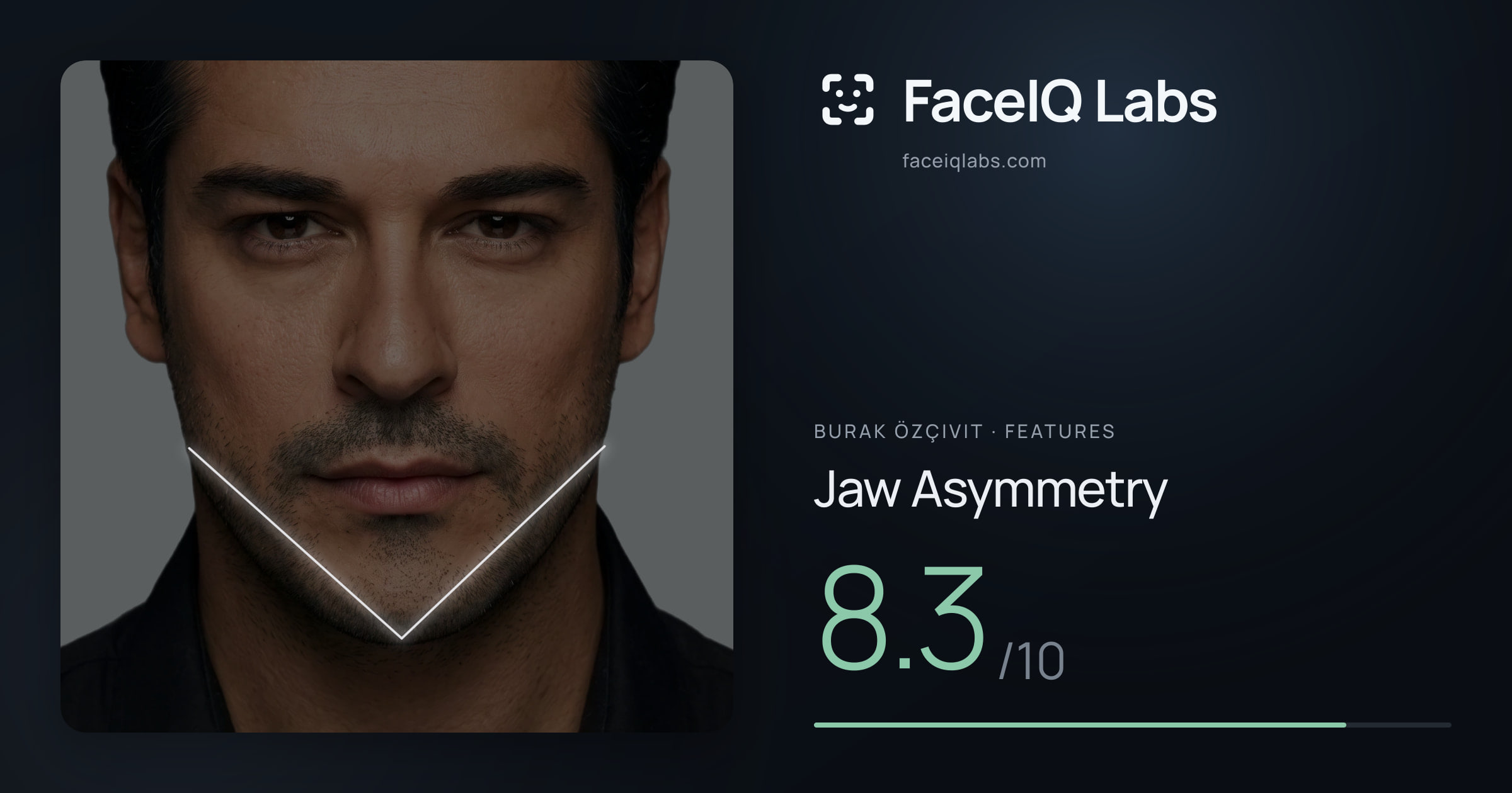 Burak Özçivit Jaw Asymmetry: 8.3/10, drawn on the photo