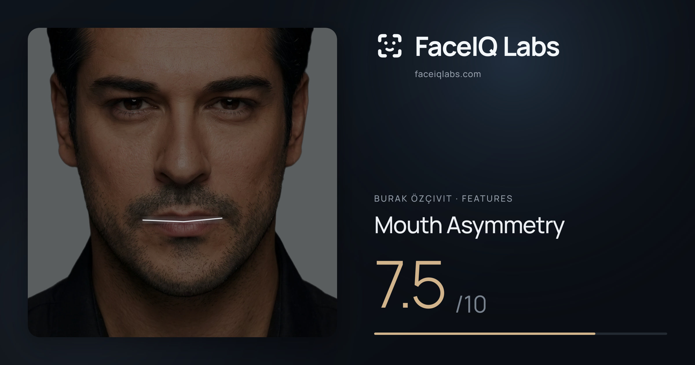 Burak Özçivit Mouth Asymmetry: 7.5/10, drawn on the photo