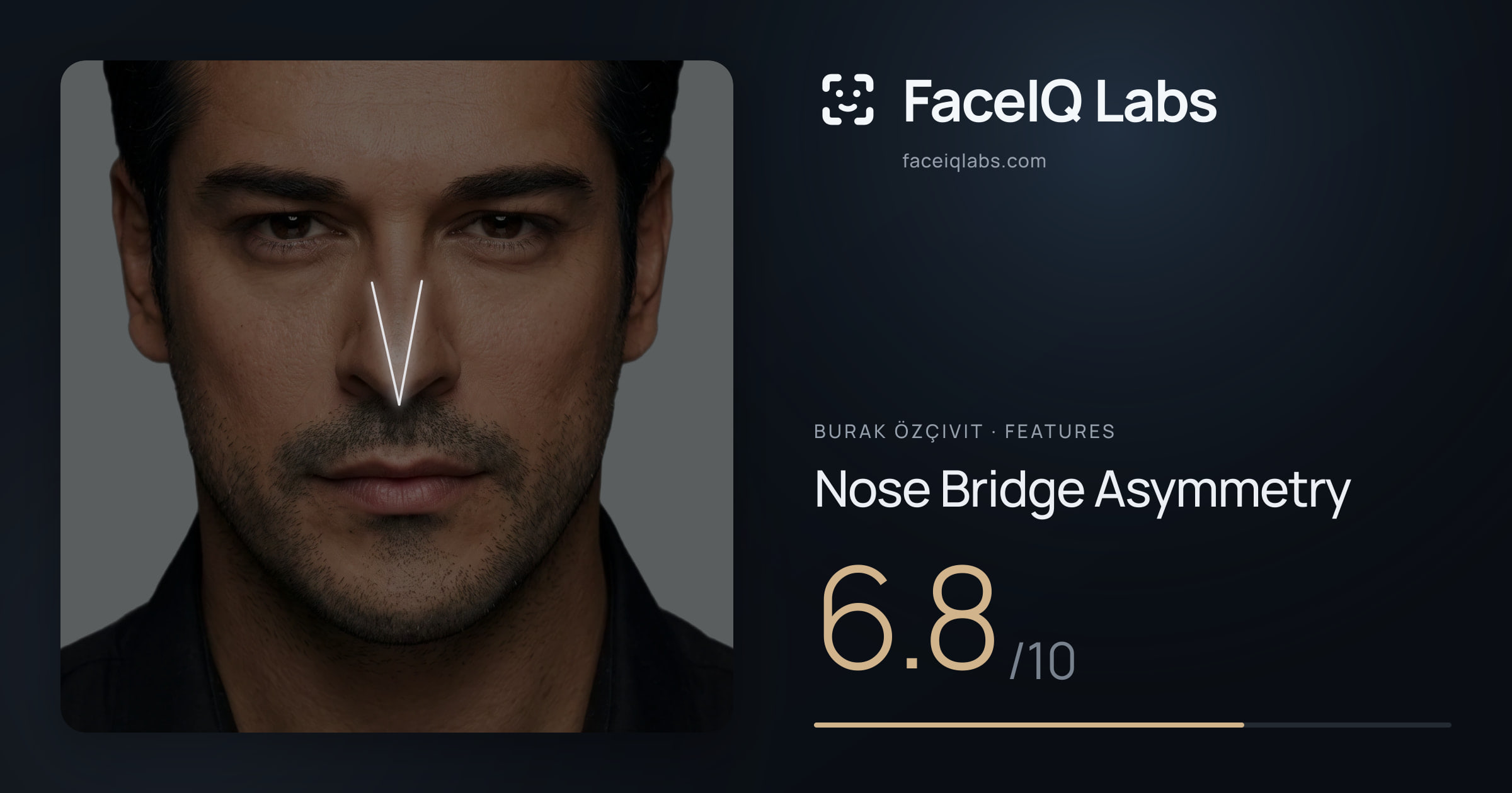 Burak Özçivit Nose Bridge Asymmetry: 6.8/10, drawn on the photo