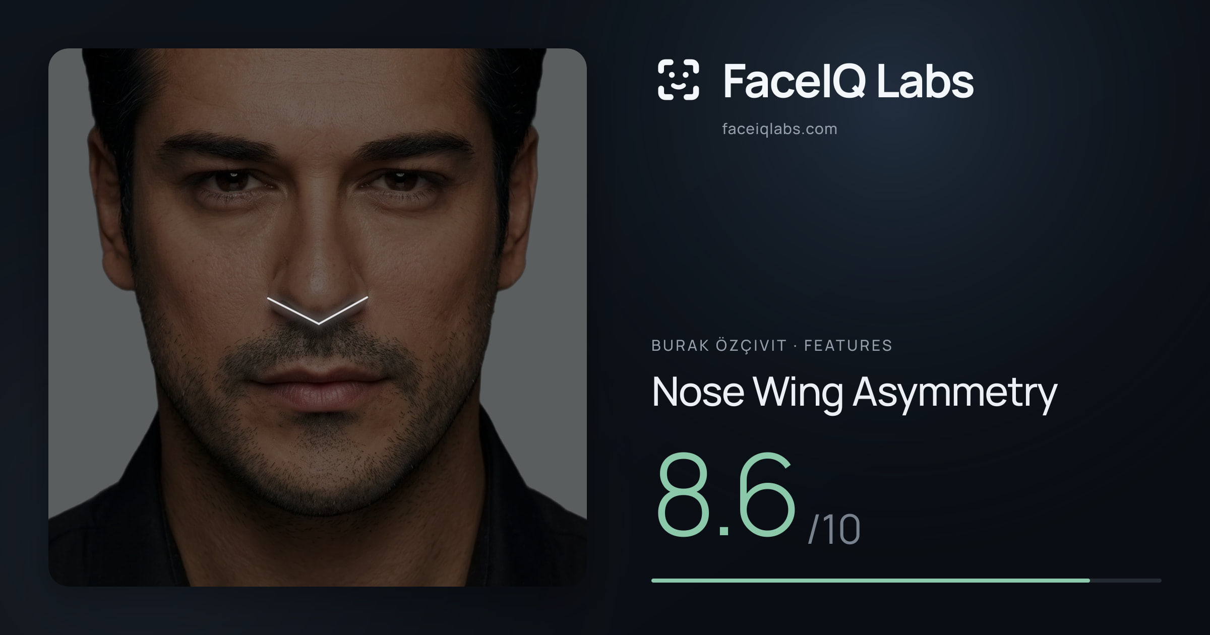 Burak Özçivit Nose Wing Asymmetry: 8.6/10, drawn on the photo