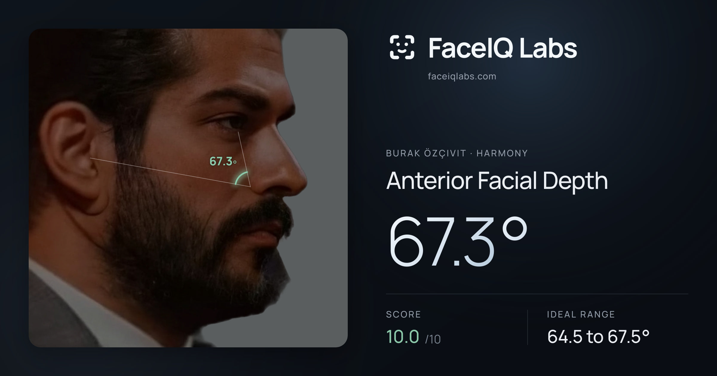 Burak Özçivit Anterior Facial Depth: 67.3°, drawn on the photo