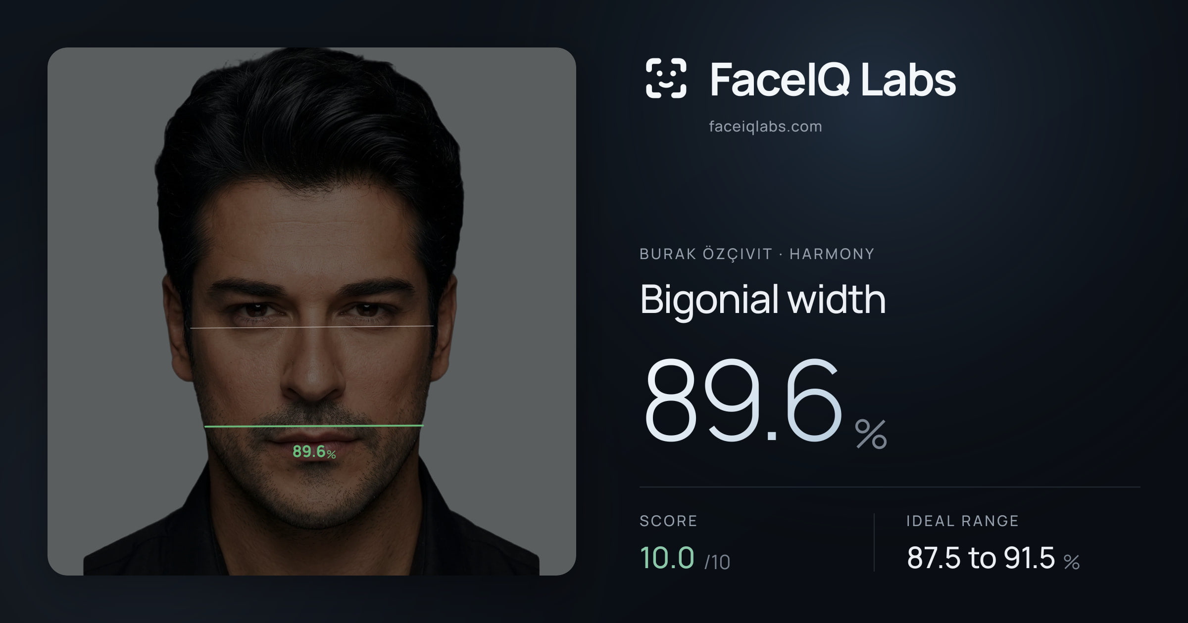 Burak Özçivit Bigonial width: 89.6%, drawn on the photo