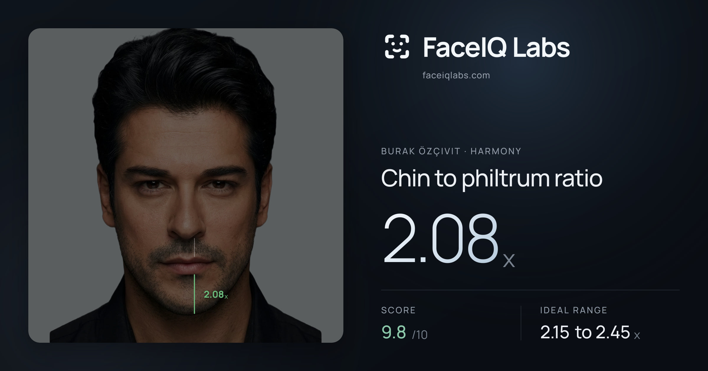 Burak Özçivit Chin to philtrum ratio: 2.08x, drawn on the photo