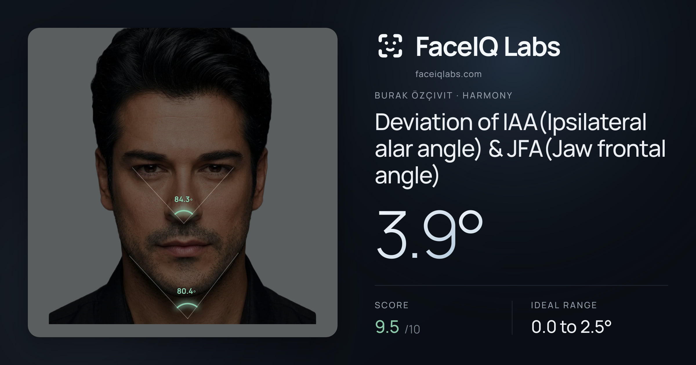 Burak Özçivit Deviation of IAA(Ipsilateral alar angle) & JFA(Jaw frontal angle): 3.9°, drawn on the photo