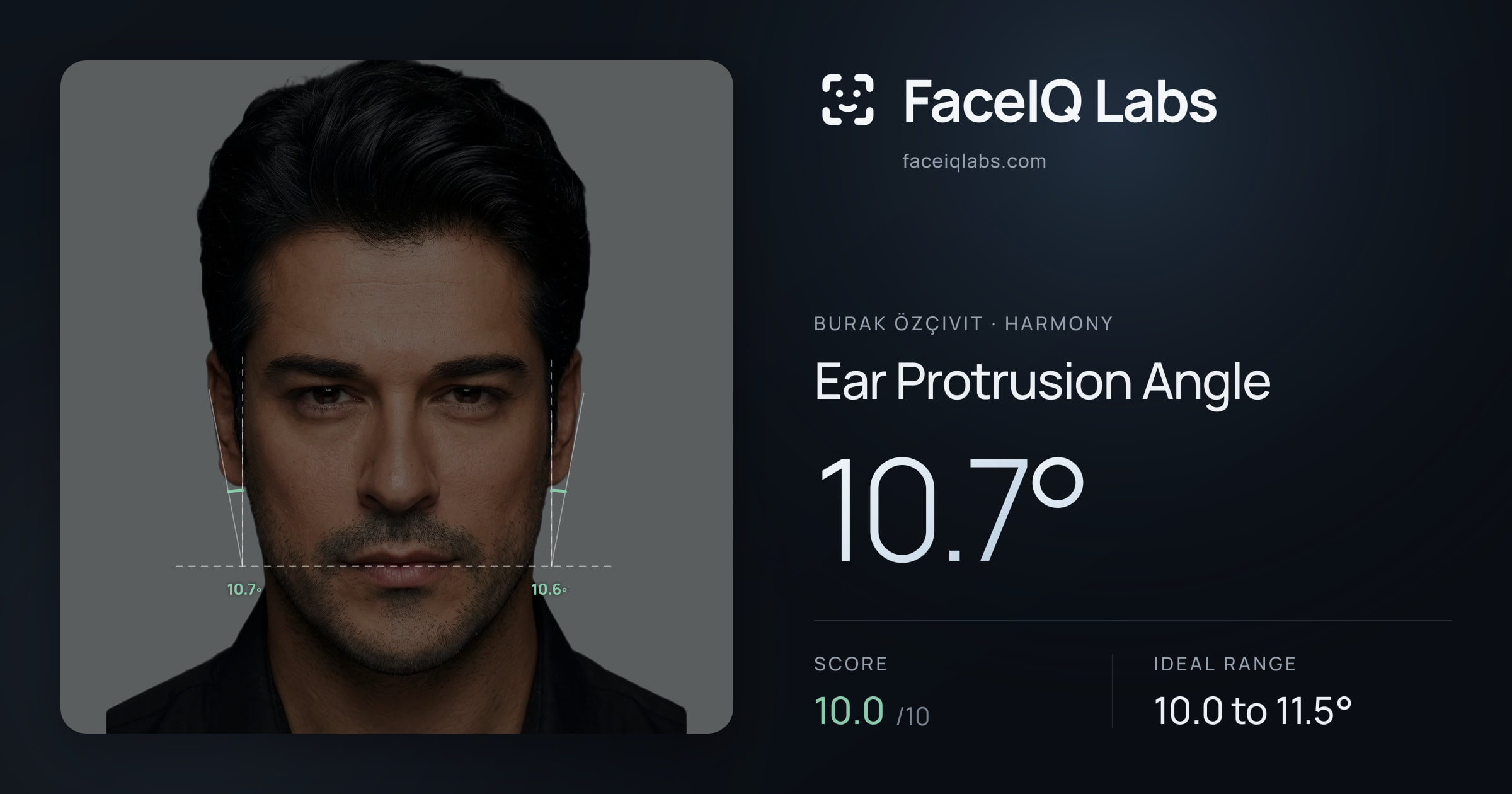 Burak Özçivit Ear Protrusion Angle: 10.7°, drawn on the photo