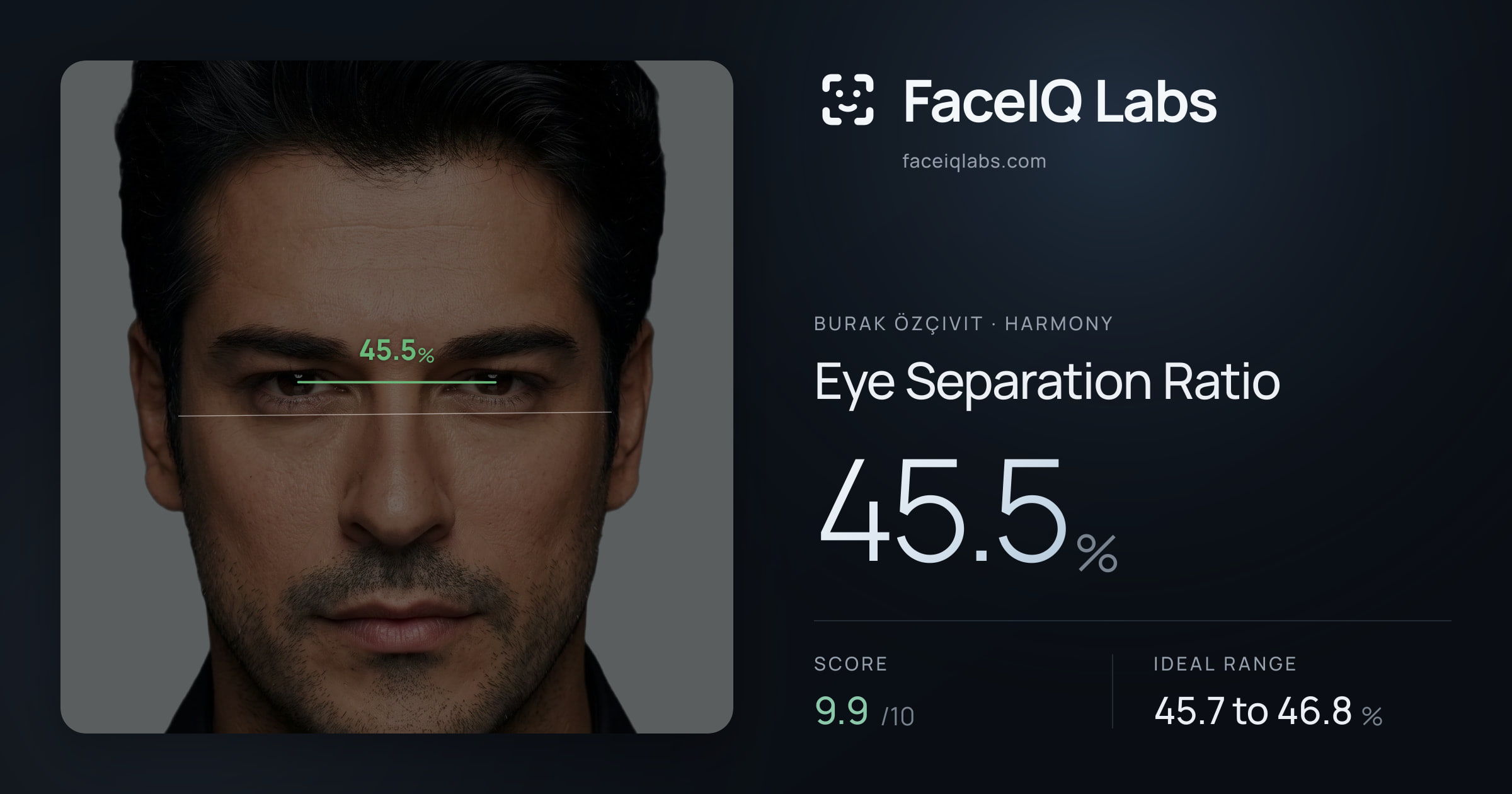 Burak Özçivit Eye Separation Ratio: 45.5%, drawn on the photo