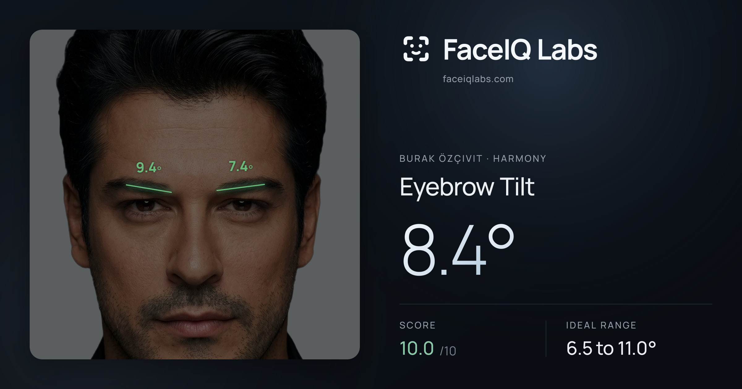 Burak Özçivit Eyebrow Tilt: 8.4°, drawn on the photo