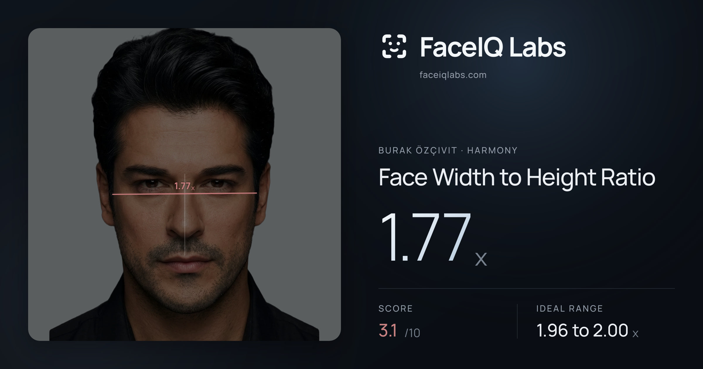 Burak Özçivit Face Width to Height Ratio: 1.77x, drawn on the photo