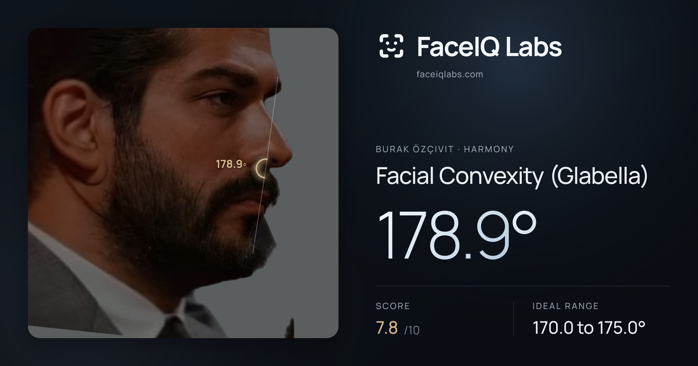 Burak Özçivit Facial Convexity (Glabella): 178.9°, drawn on the photo