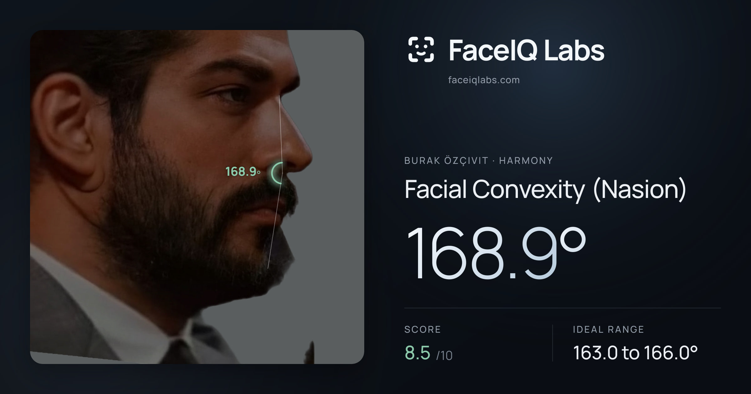 Burak Özçivit Facial Convexity (Nasion): 168.9°, drawn on the photo