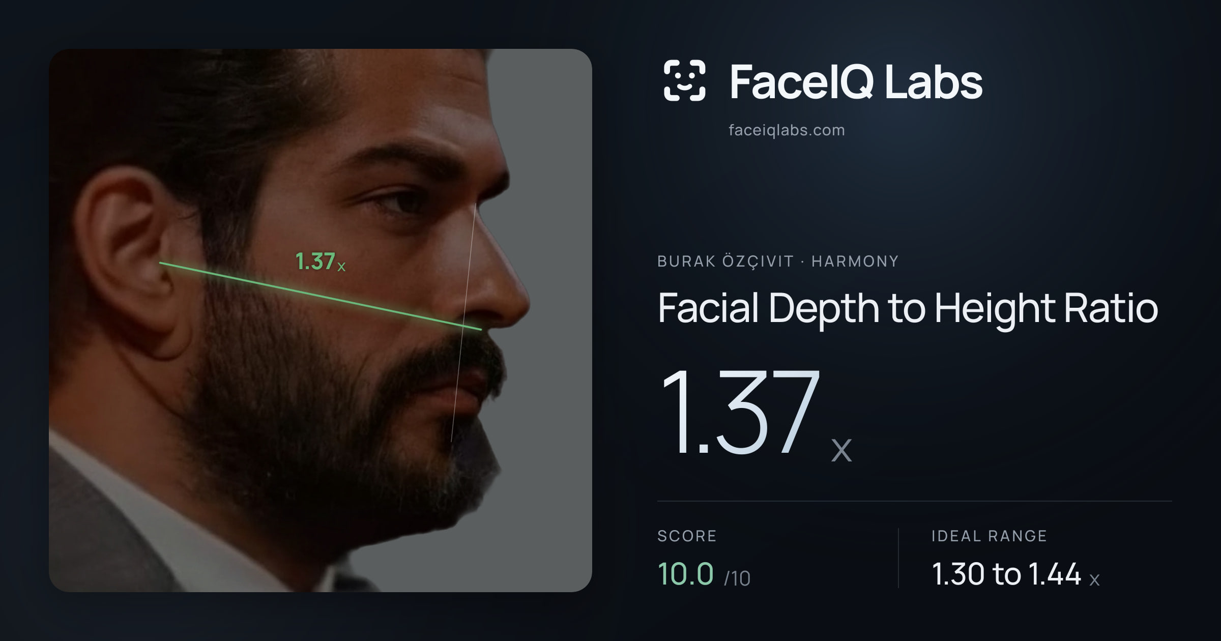 Burak Özçivit Facial Depth to Height Ratio: 1.37x, drawn on the photo