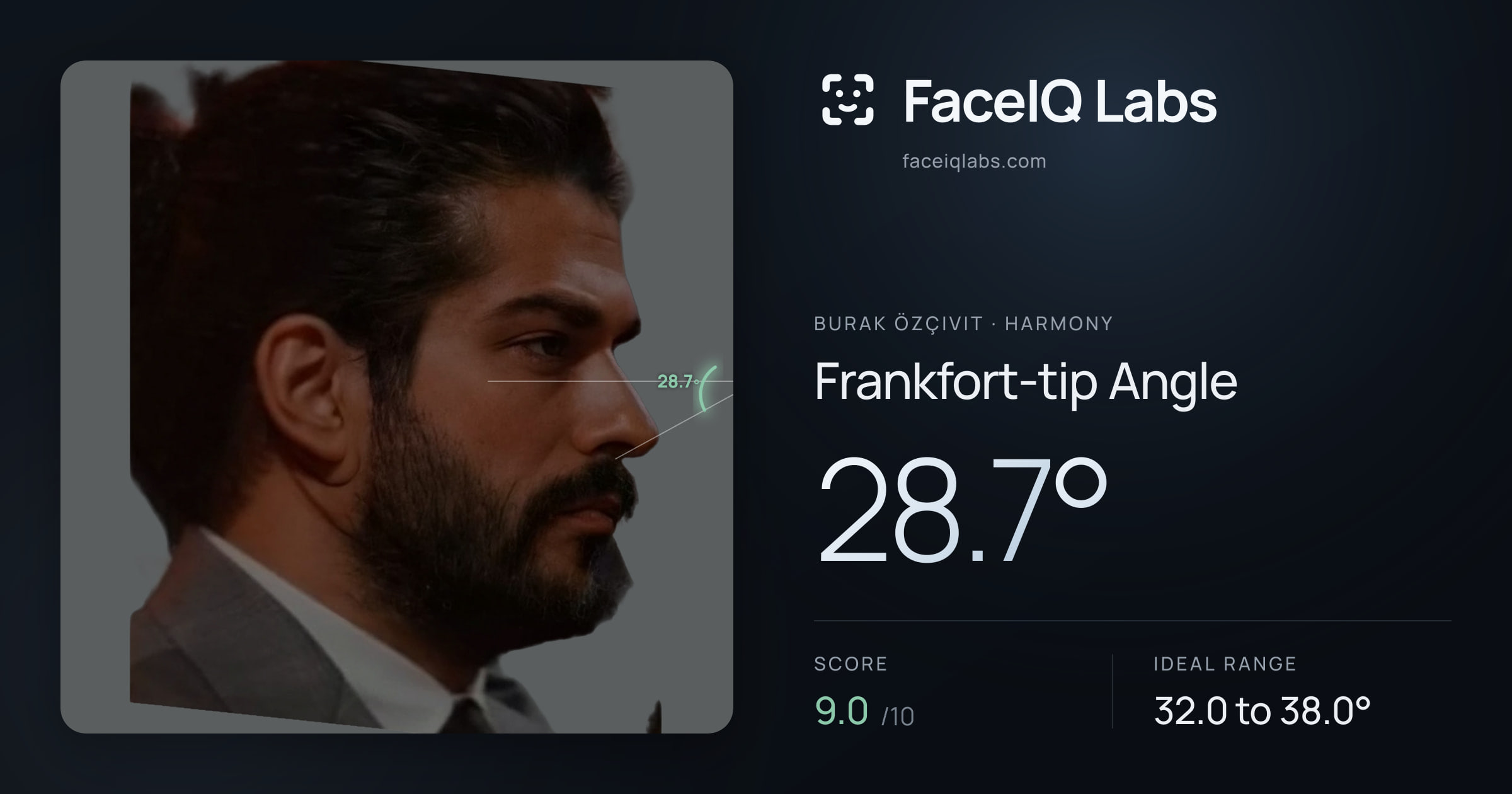 Burak Özçivit Frankfort-tip Angle: 28.7°, drawn on the photo