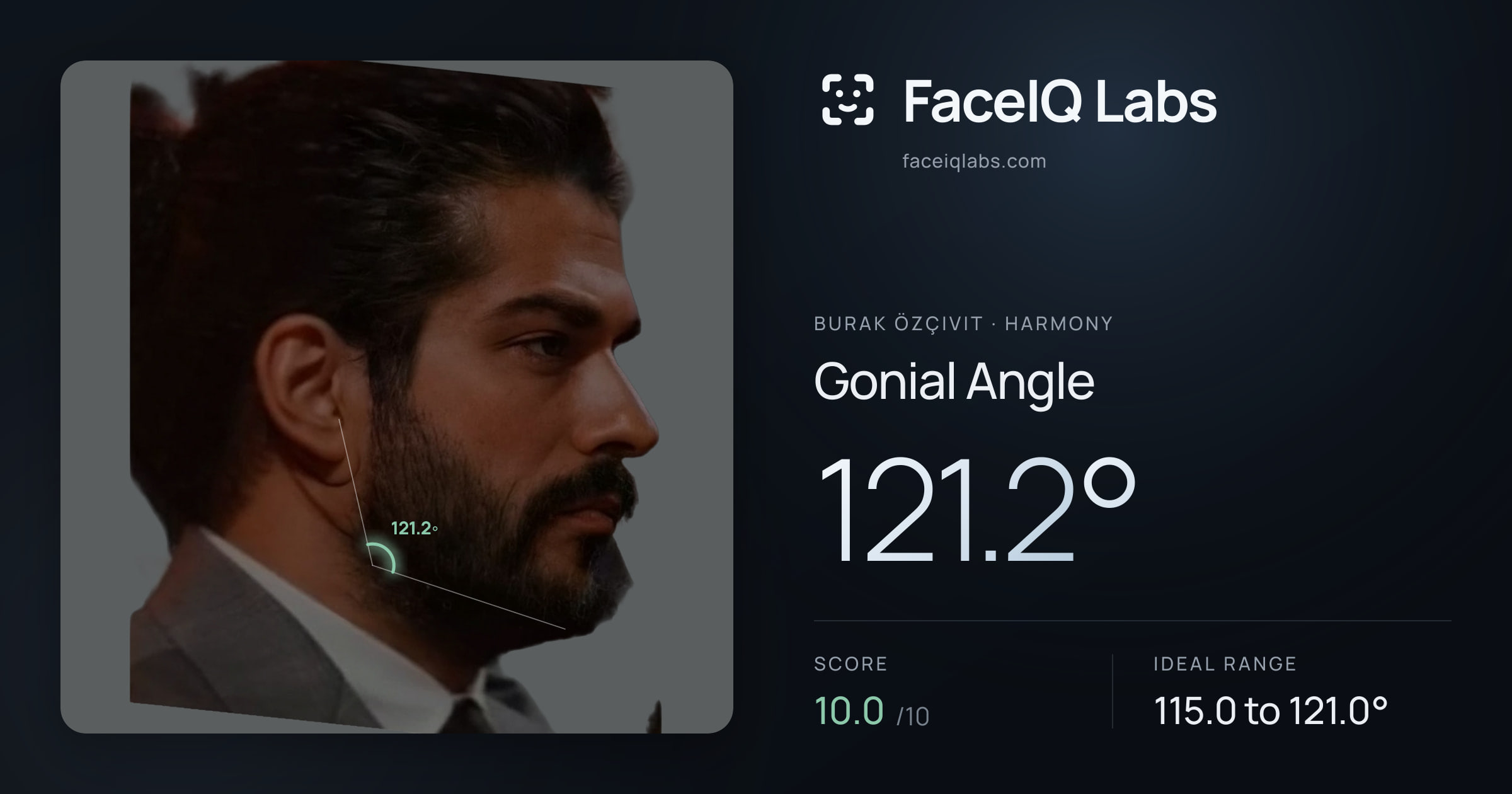 Burak Özçivit Gonial Angle: 121.2°, drawn on the photo