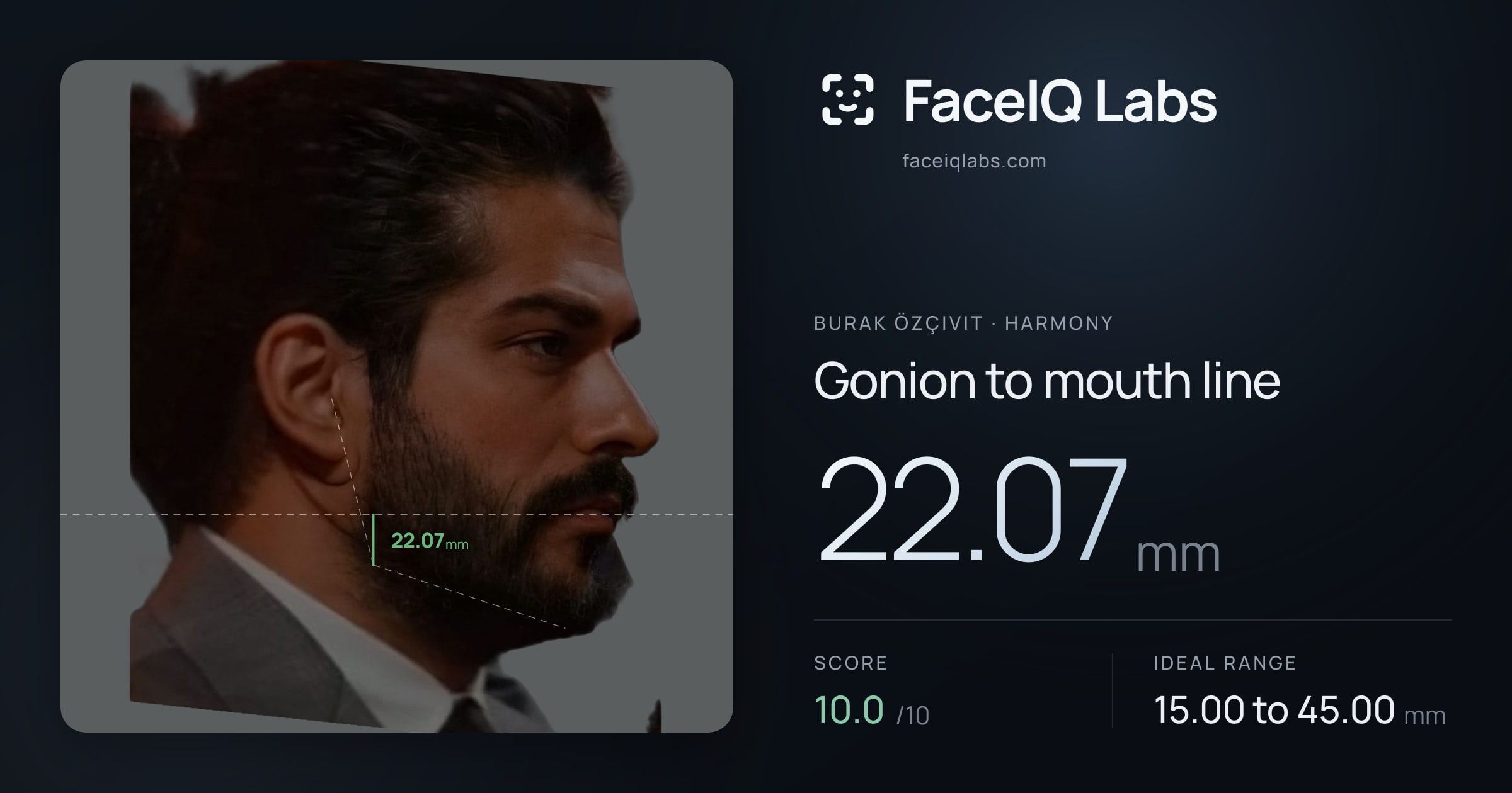Burak Özçivit Gonion to mouth line: 22.07mm, drawn on the photo