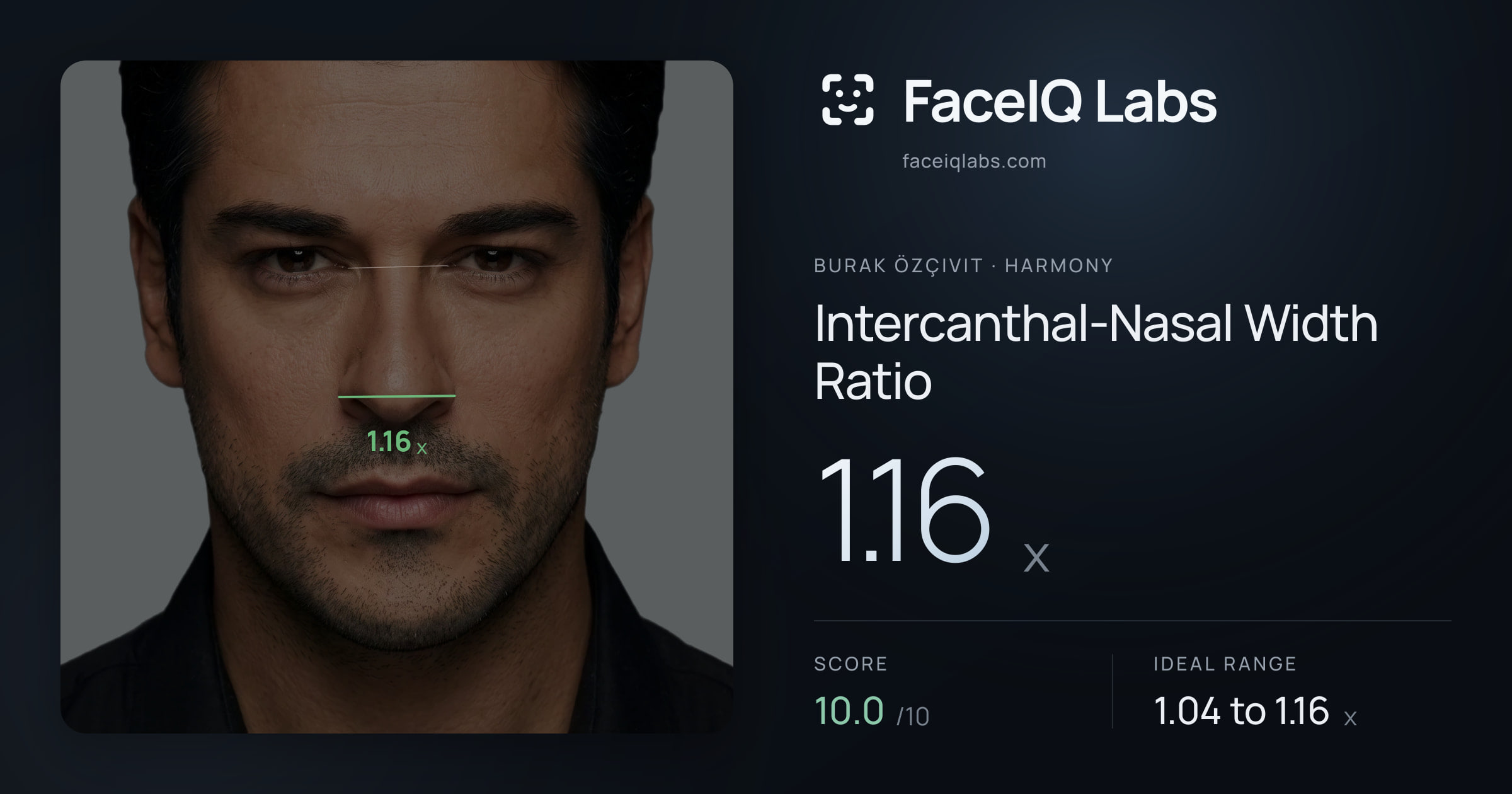 Burak Özçivit Intercanthal-Nasal Width Ratio: 1.16x, drawn on the photo