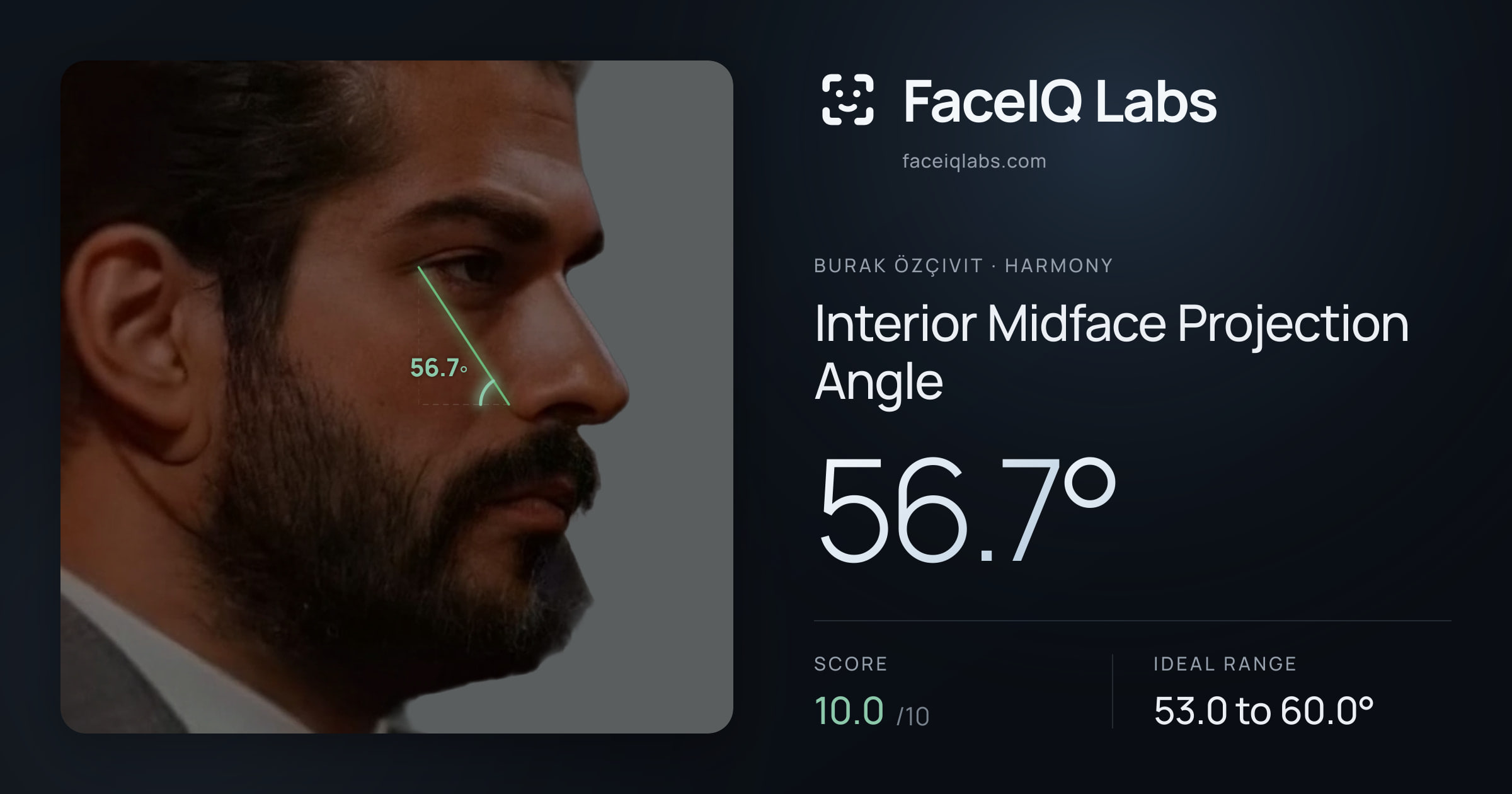 Burak Özçivit Interior Midface Projection Angle: 56.7°, drawn on the photo