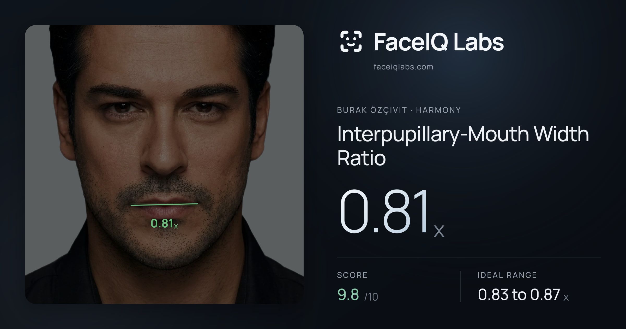 Burak Özçivit Interpupillary-Mouth Width Ratio: 0.81x, drawn on the photo