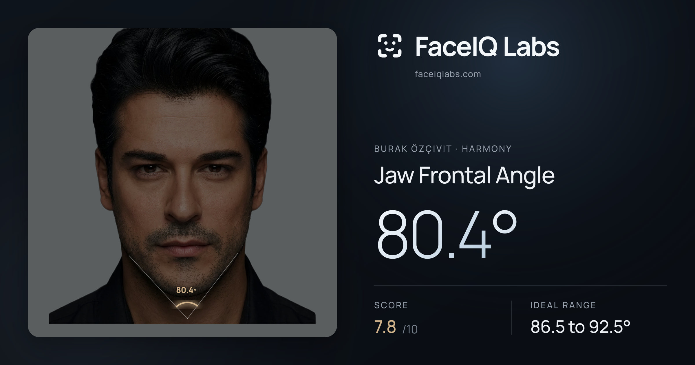 Burak Özçivit Jaw Frontal Angle: 80.4°, drawn on the photo