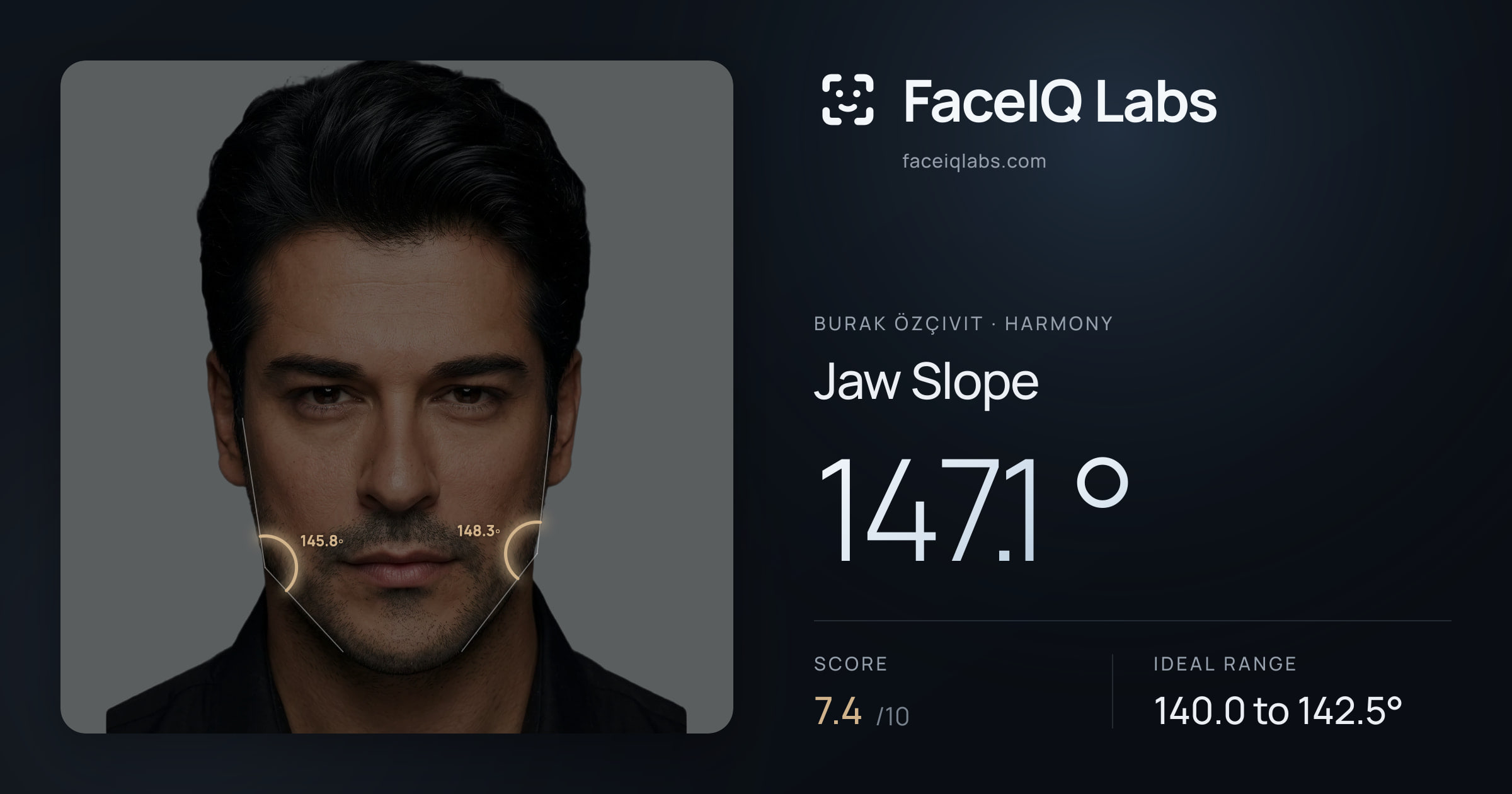 Burak Özçivit Jaw Slope: 147.1°, drawn on the photo