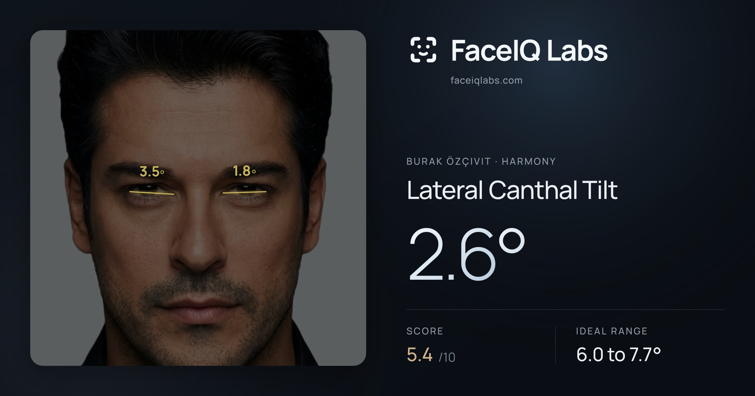 Burak Özçivit Lateral Canthal Tilt: 2.6°, drawn on the photo