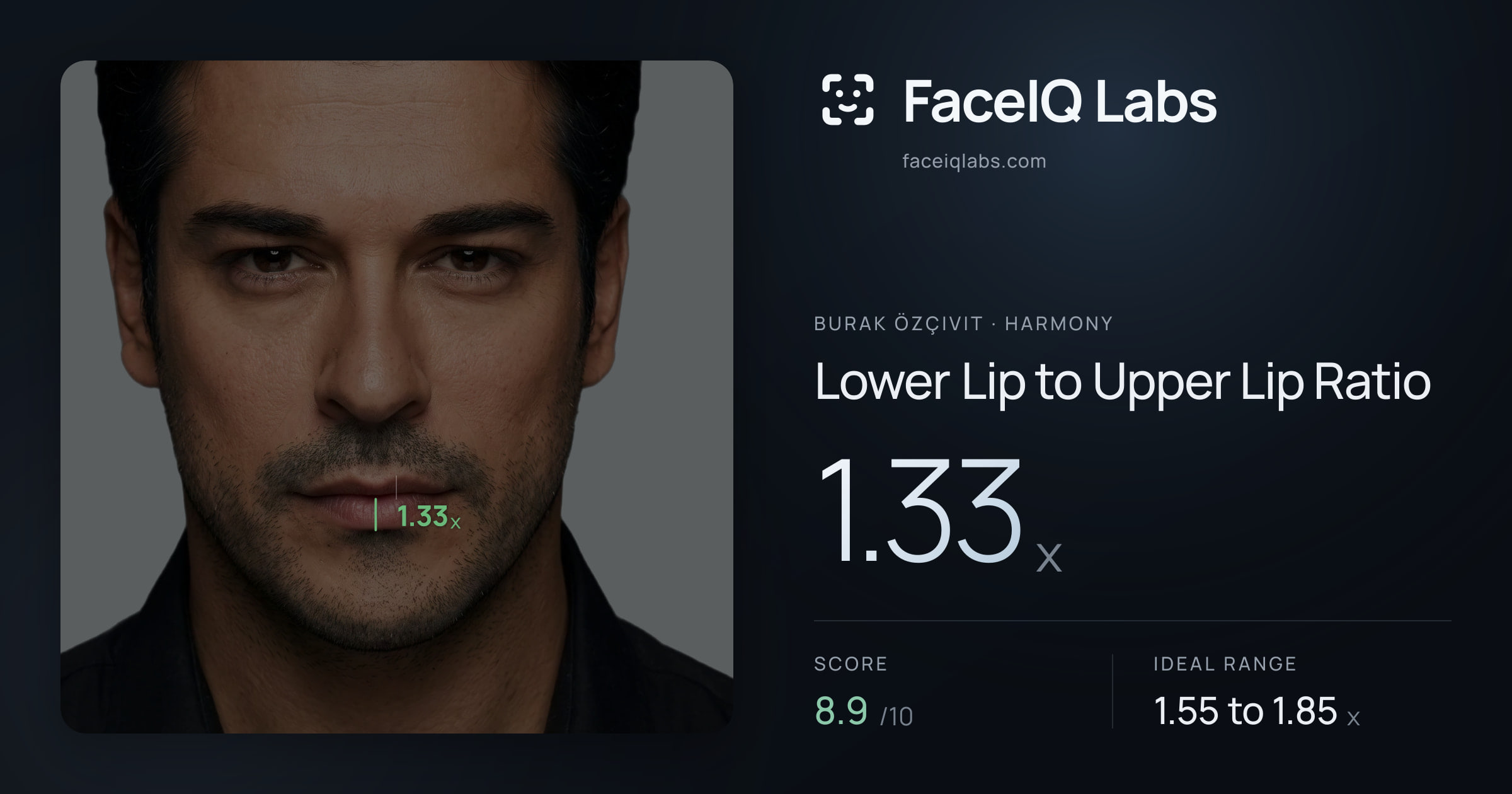 Burak Özçivit Lower Lip to Upper Lip Ratio: 1.33x, drawn on the photo