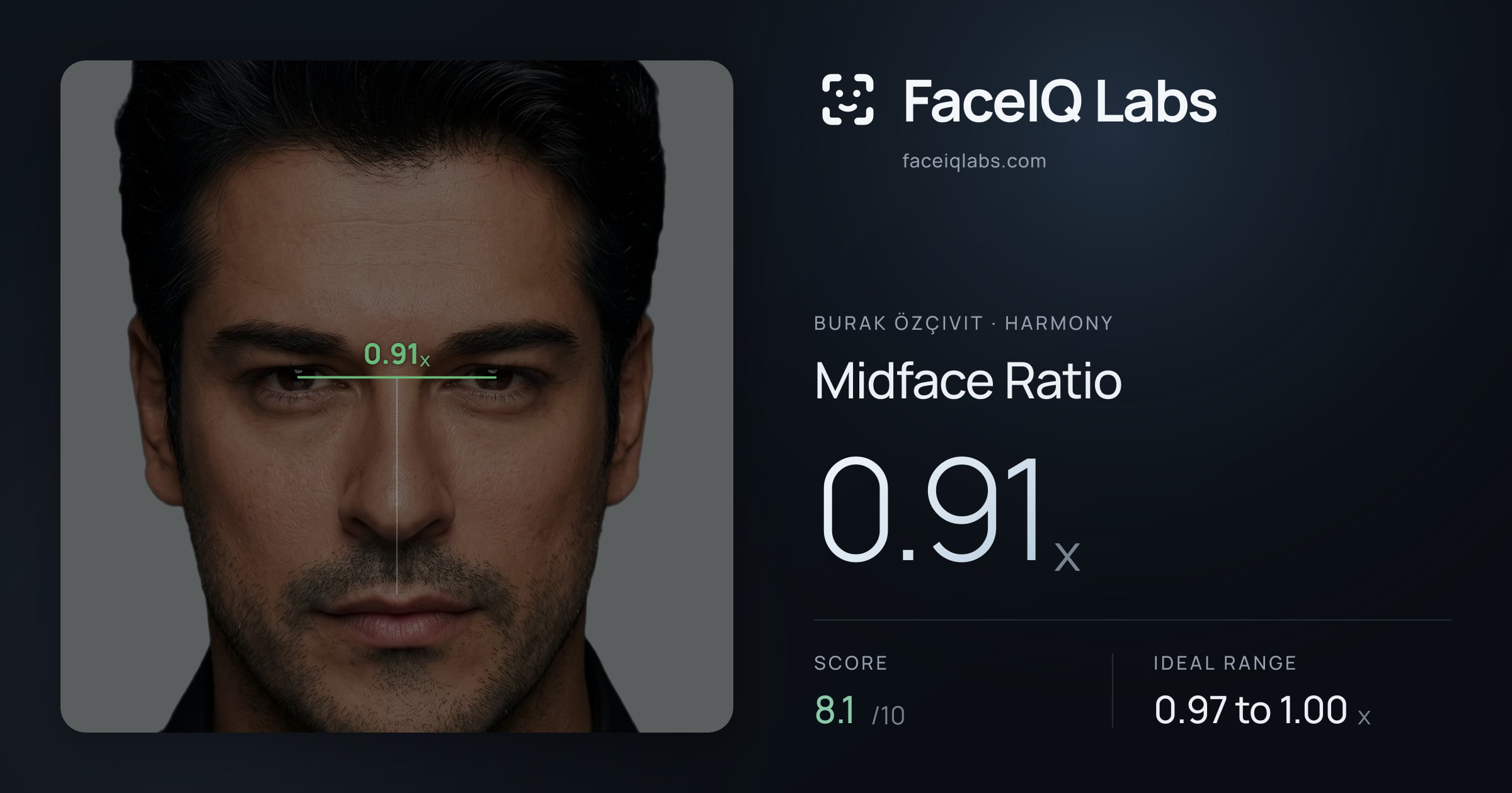 Burak Özçivit Midface Ratio: 0.91x, drawn on the photo