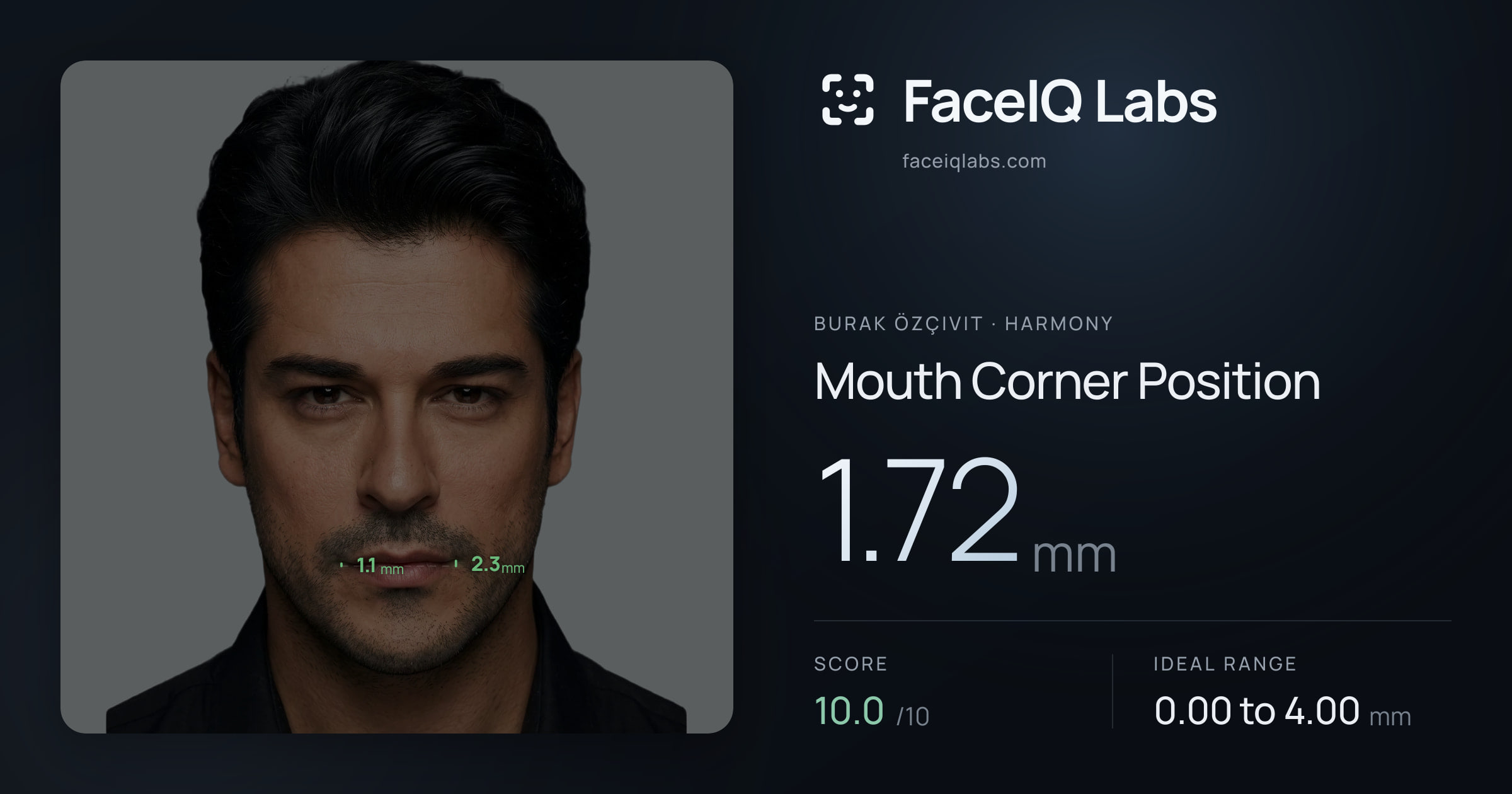 Burak Özçivit Mouth Corner Position: 1.72mm, drawn on the photo