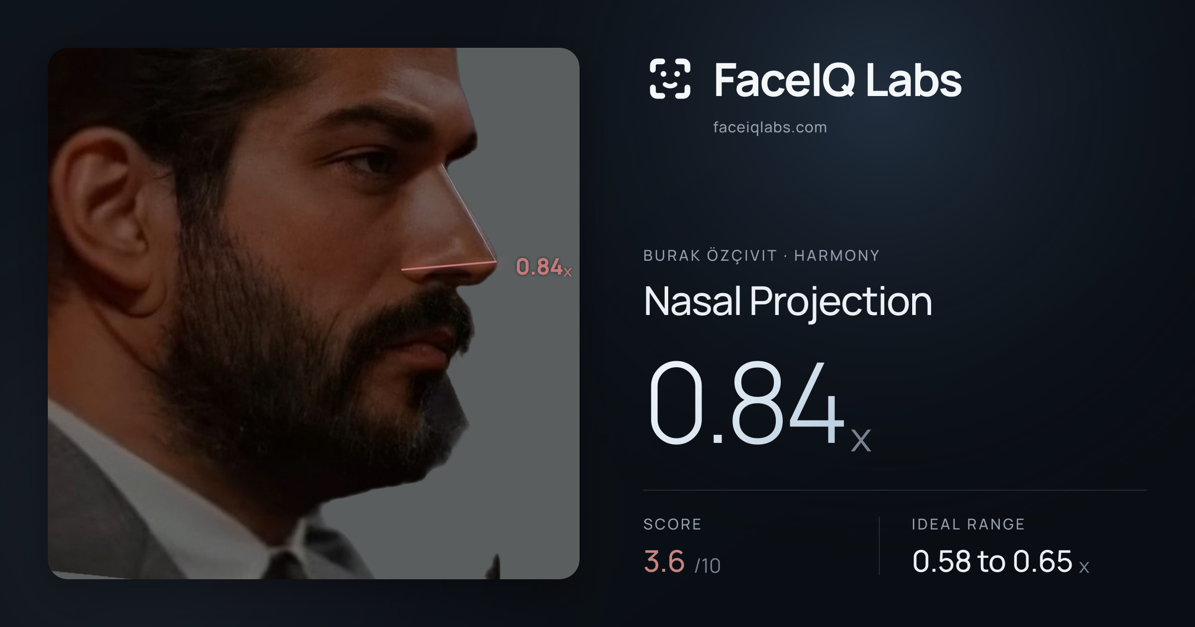 Burak Özçivit Nasal Projection: 0.84x, drawn on the photo