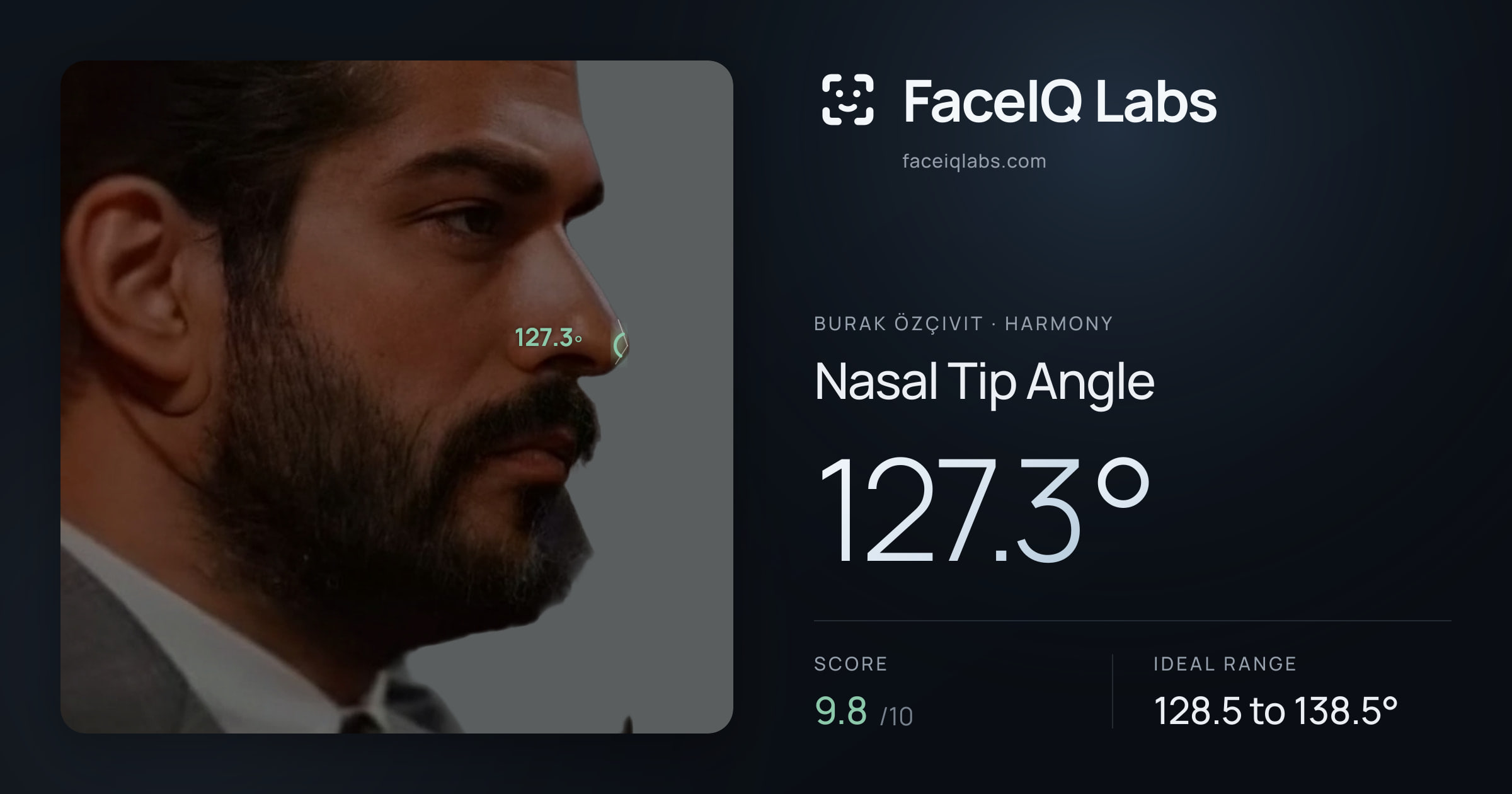 Burak Özçivit Nasal Tip Angle: 127.3°, drawn on the photo