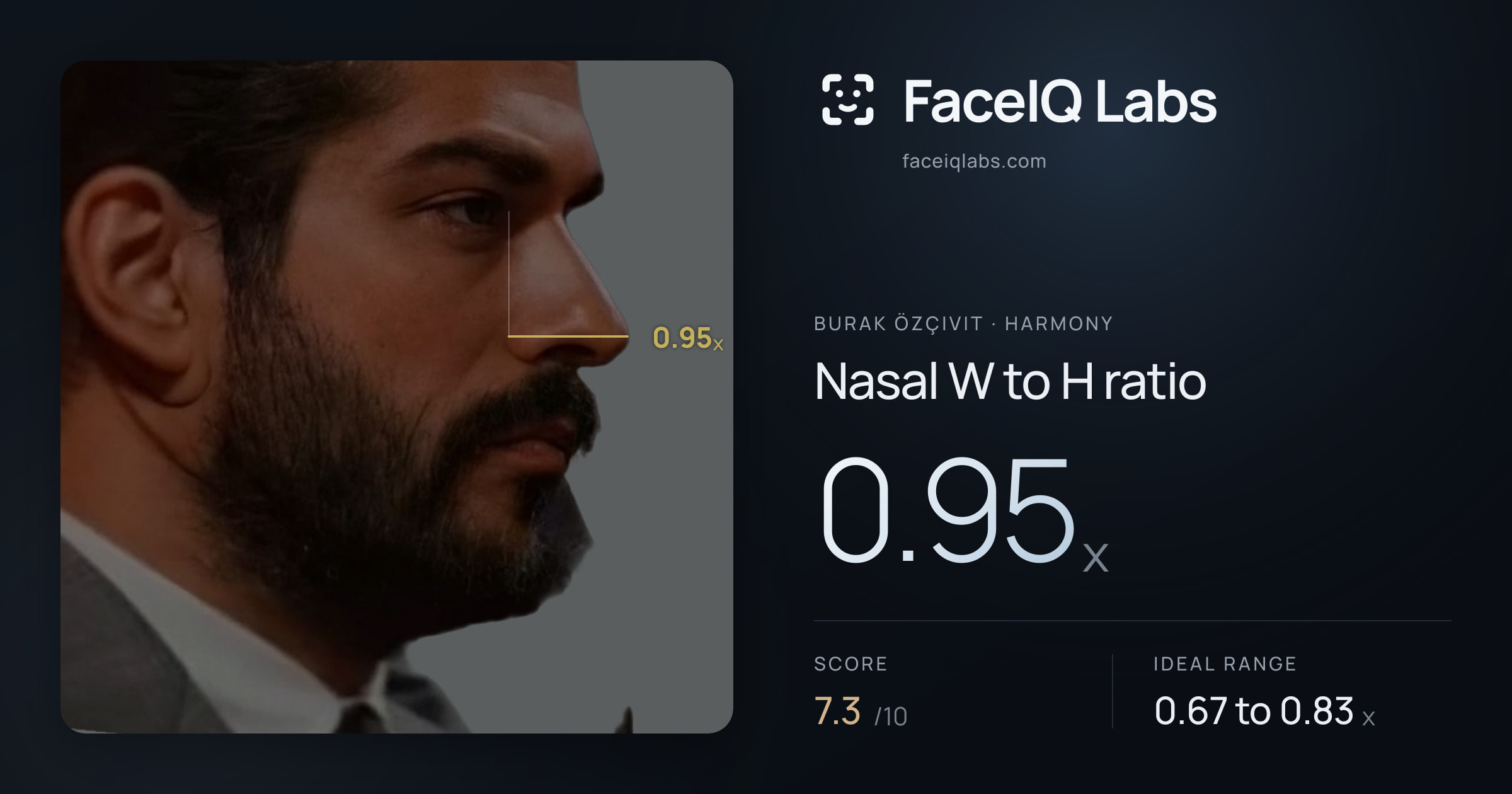 Burak Özçivit Nasal W to H ratio: 0.95x, drawn on the photo