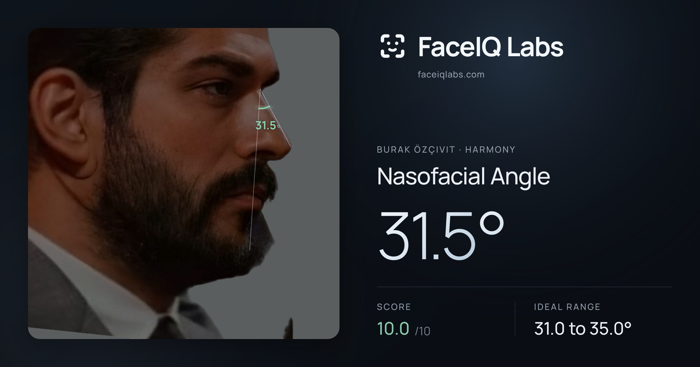 Burak Özçivit Nasofacial Angle: 31.5°, drawn on the photo