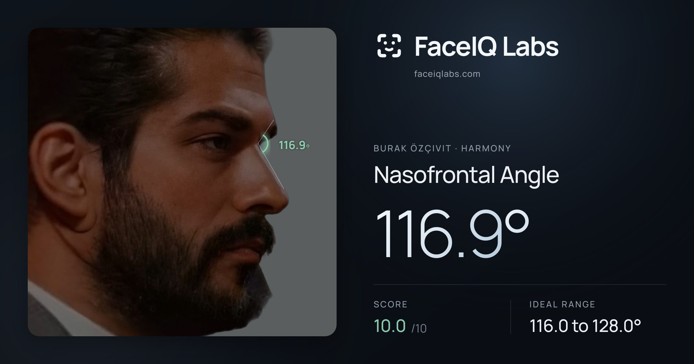 Burak Özçivit Nasofrontal Angle: 116.9°, drawn on the photo