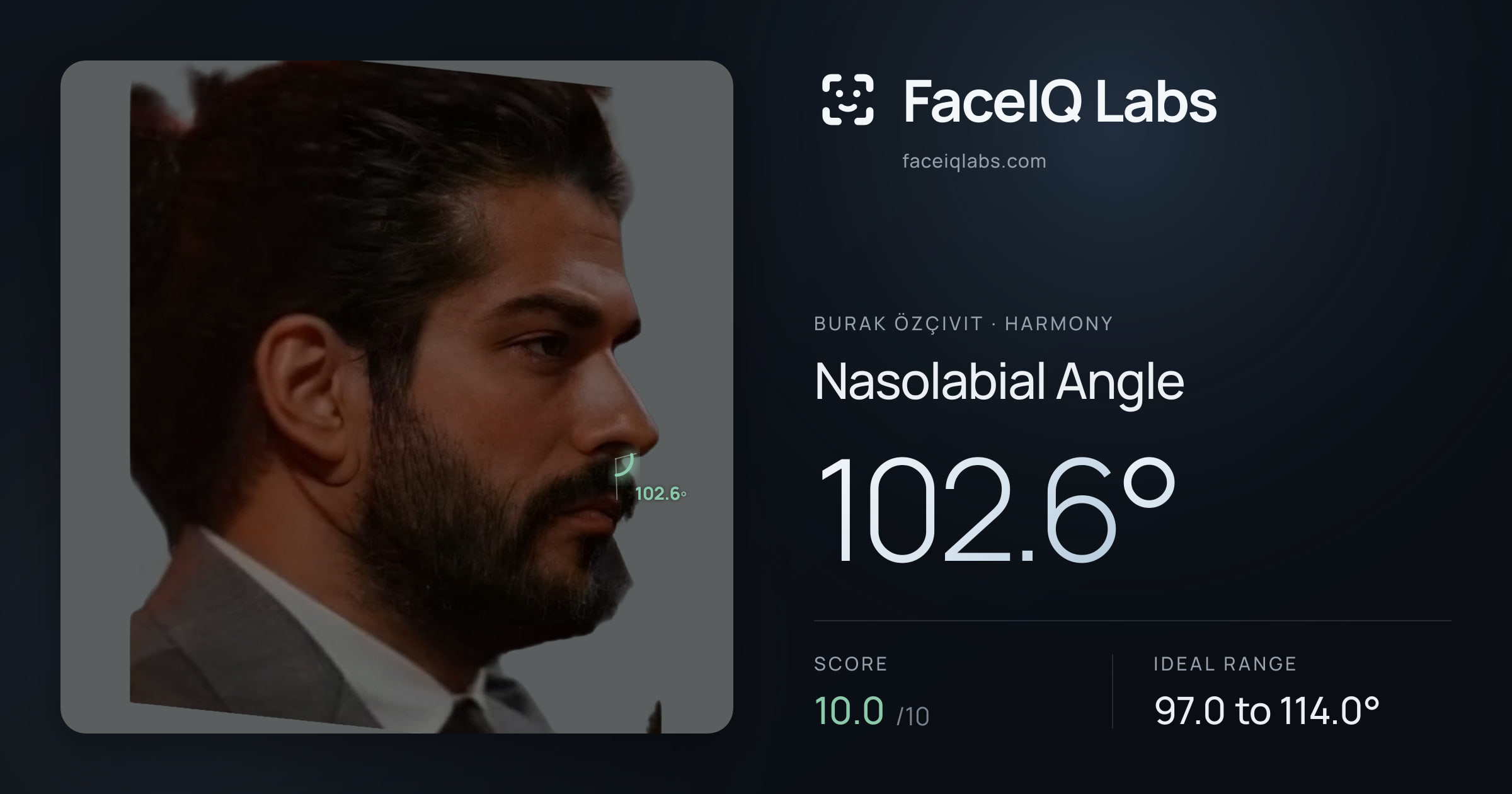 Burak Özçivit Nasolabial Angle: 102.6°, drawn on the photo