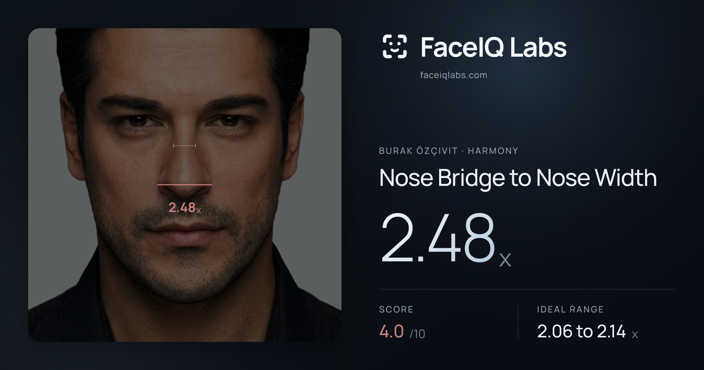Burak Özçivit Nose Bridge to Nose Width: 2.48x, drawn on the photo