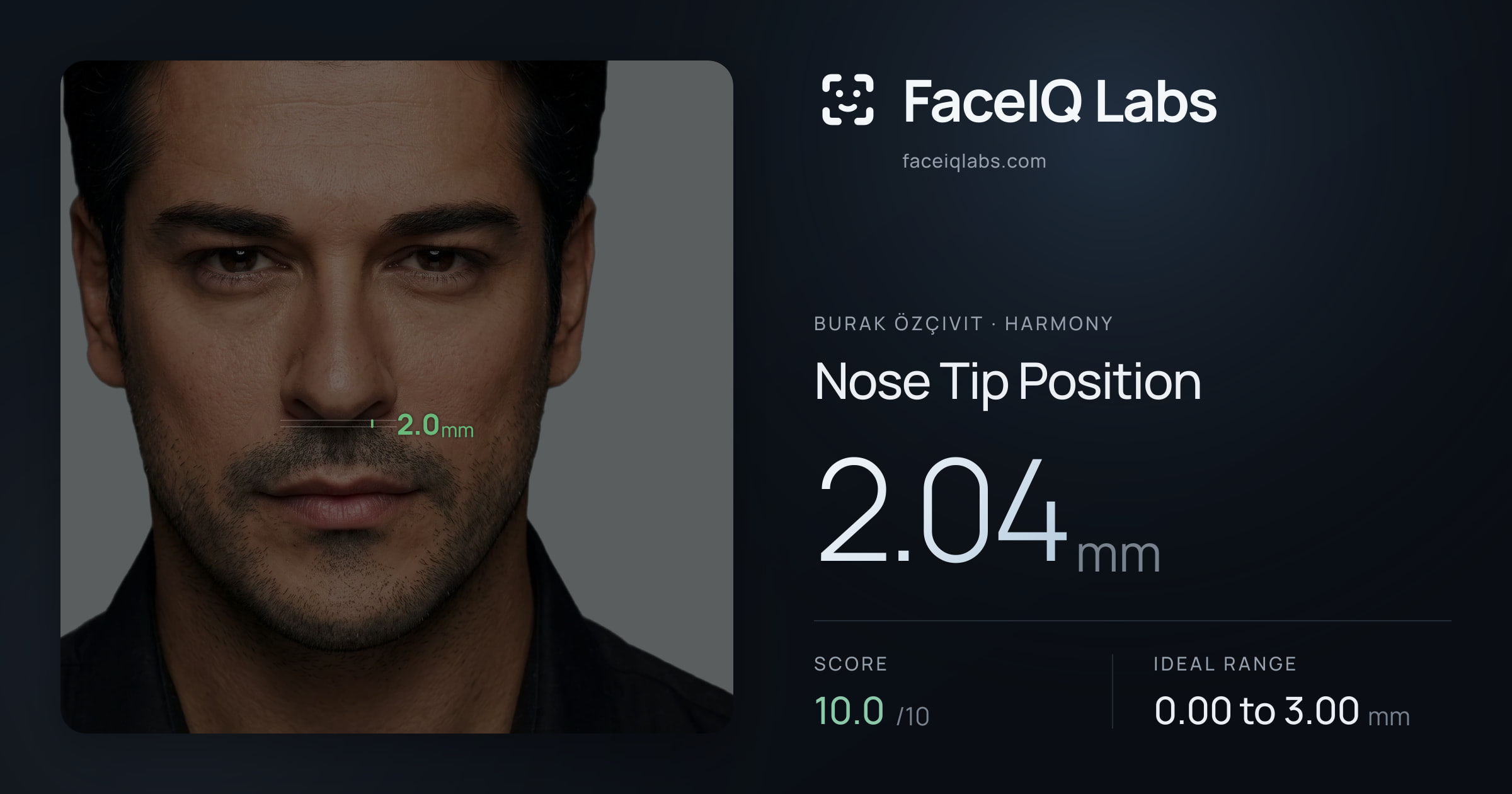 Burak Özçivit Nose Tip Position: 2.04mm, drawn on the photo