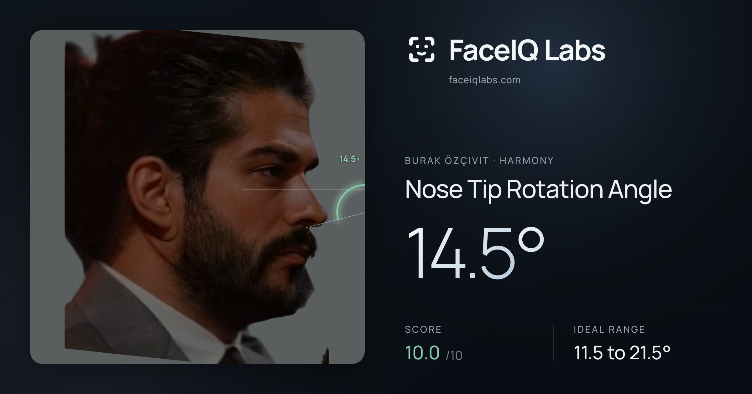 Burak Özçivit Nose Tip Rotation Angle: 14.5°, drawn on the photo