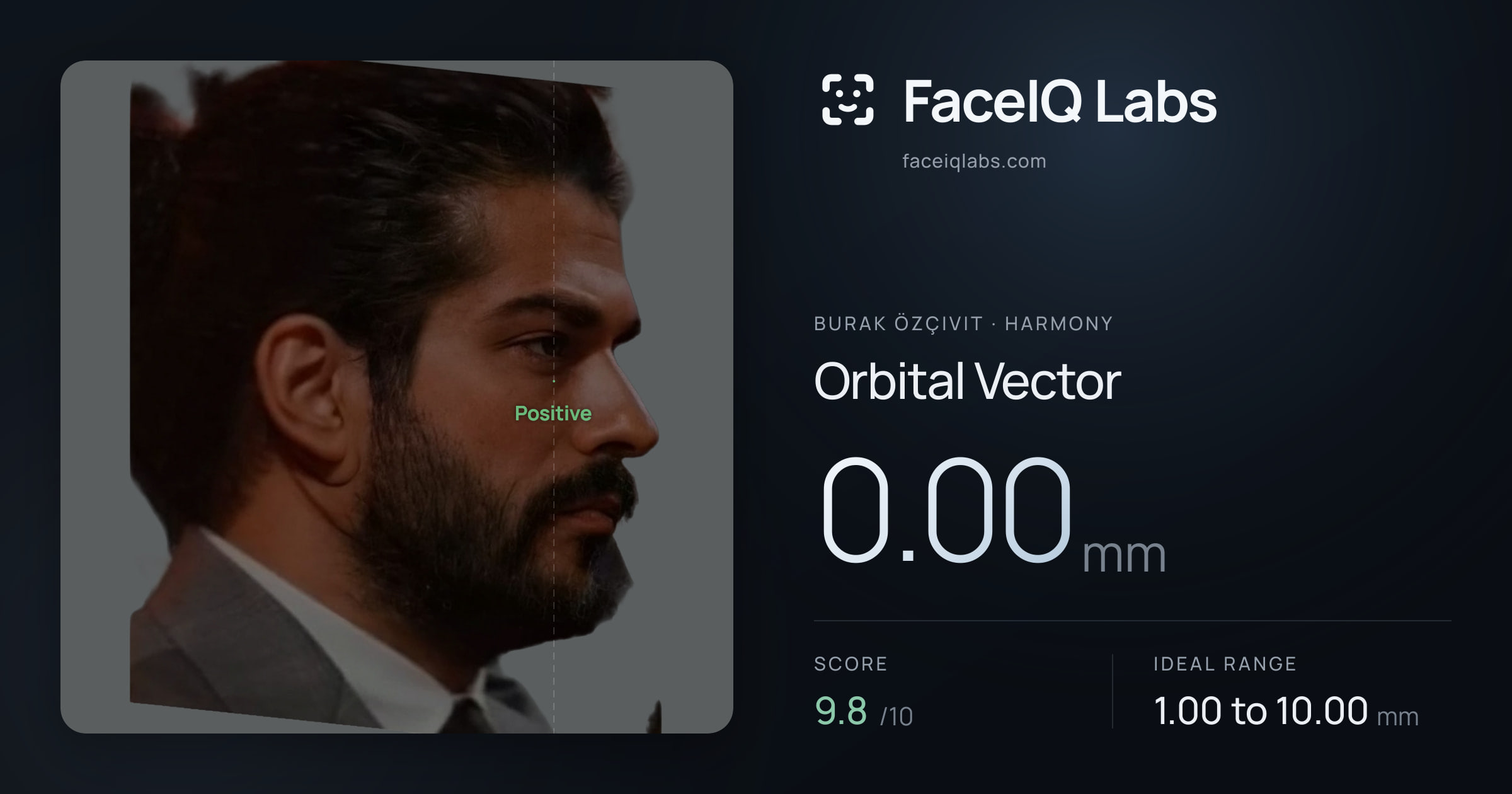 Burak Özçivit Orbital Vector: 0.00mm, drawn on the photo