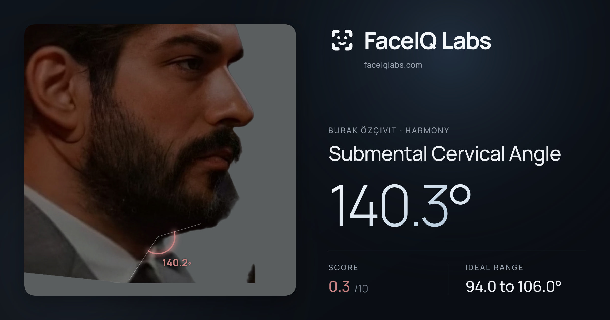 Burak Özçivit Submental Cervical Angle: 140.3°, drawn on the photo