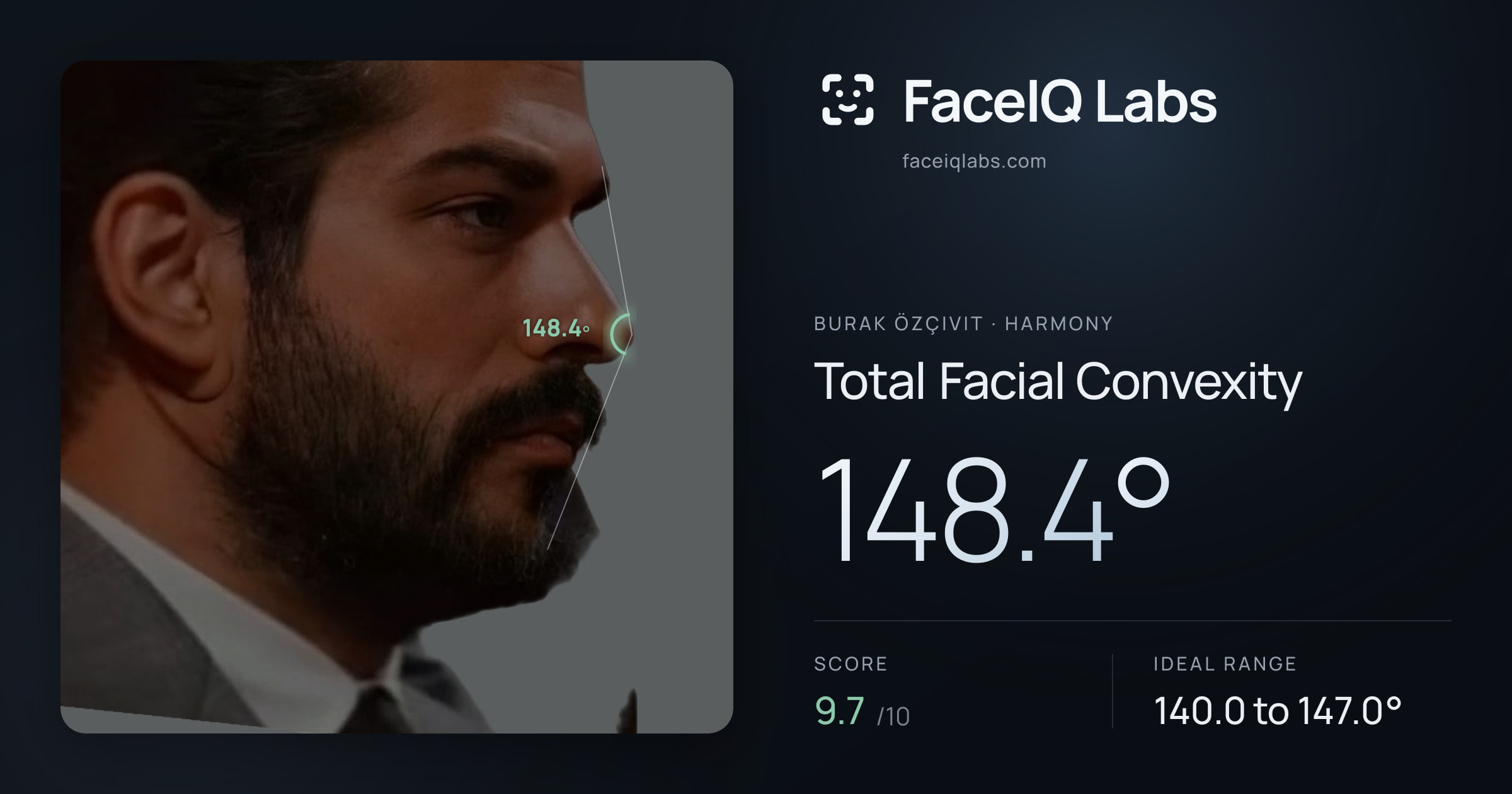 Burak Özçivit Total Facial Convexity: 148.4°, drawn on the photo